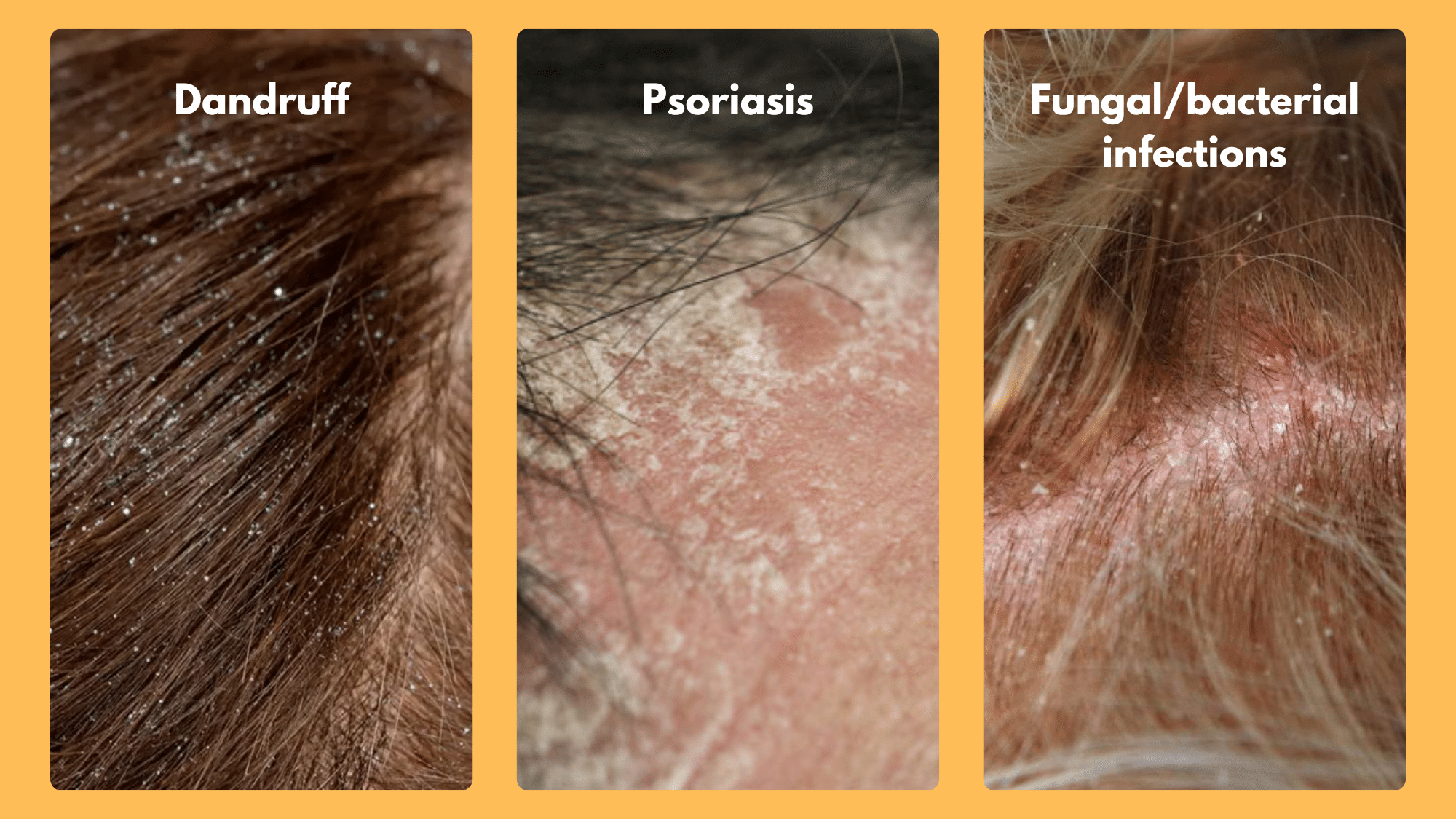 Underlying Conditions