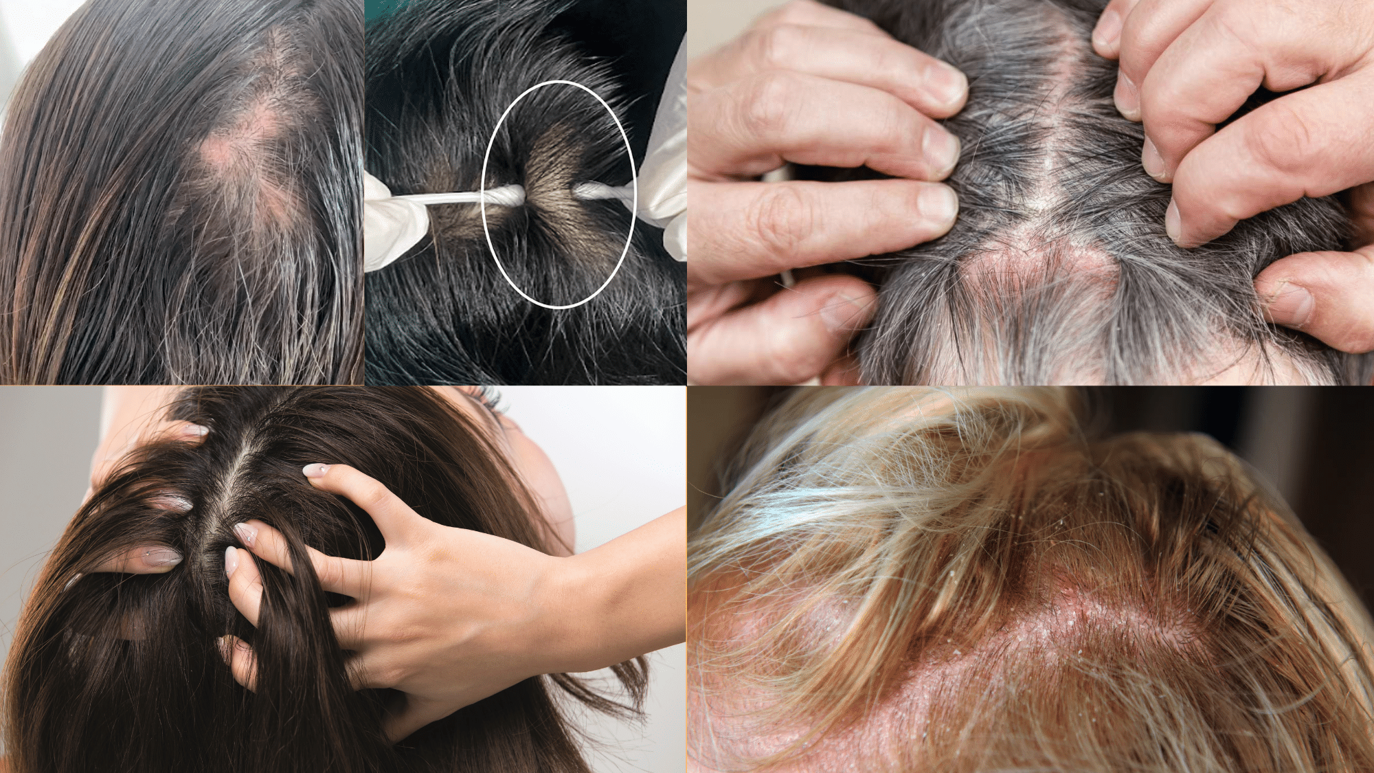 When It’s More Than Just an Annoyance