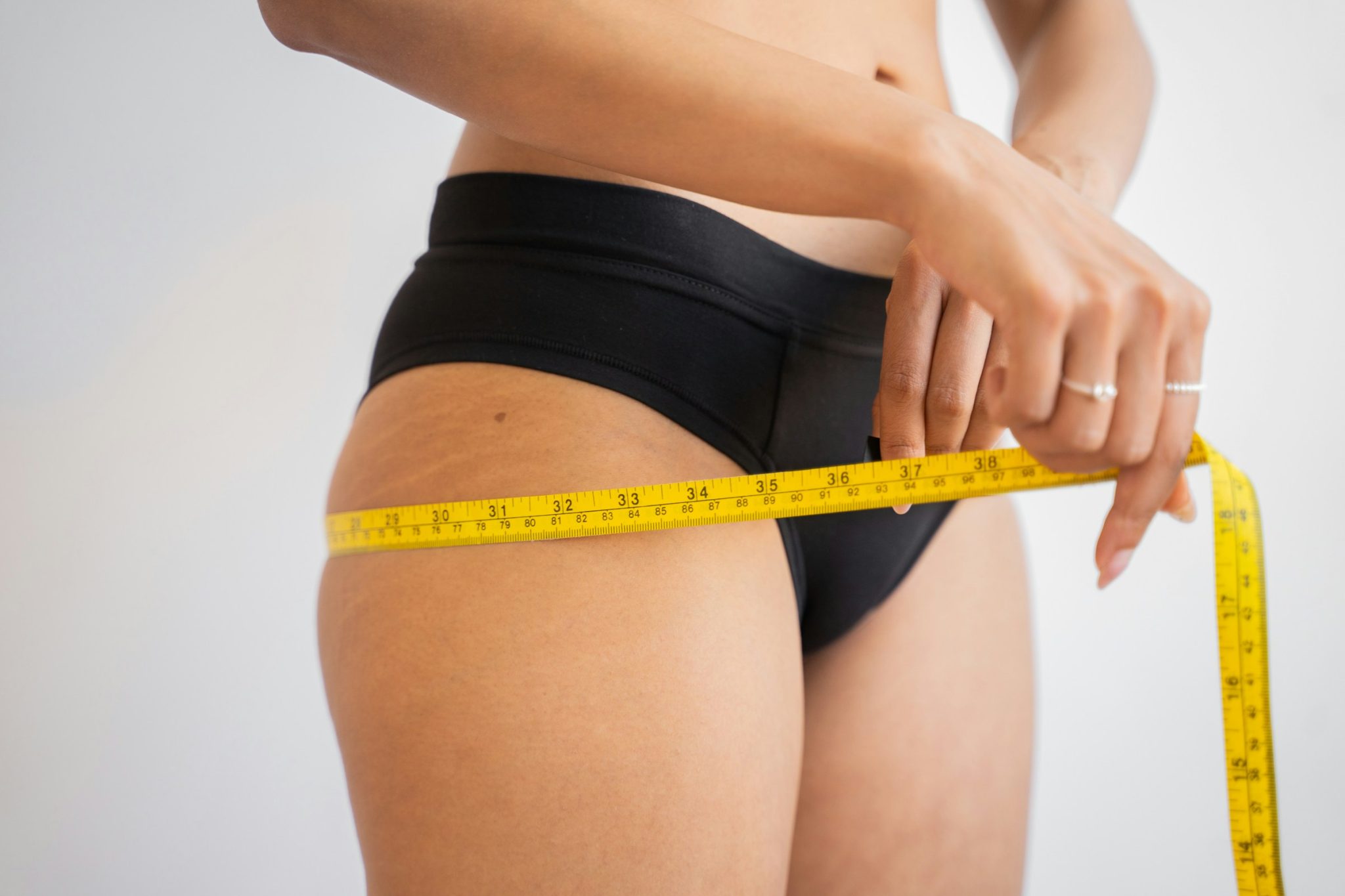 The Growing Demand for Medical Weight Management — and What Patients Should Know