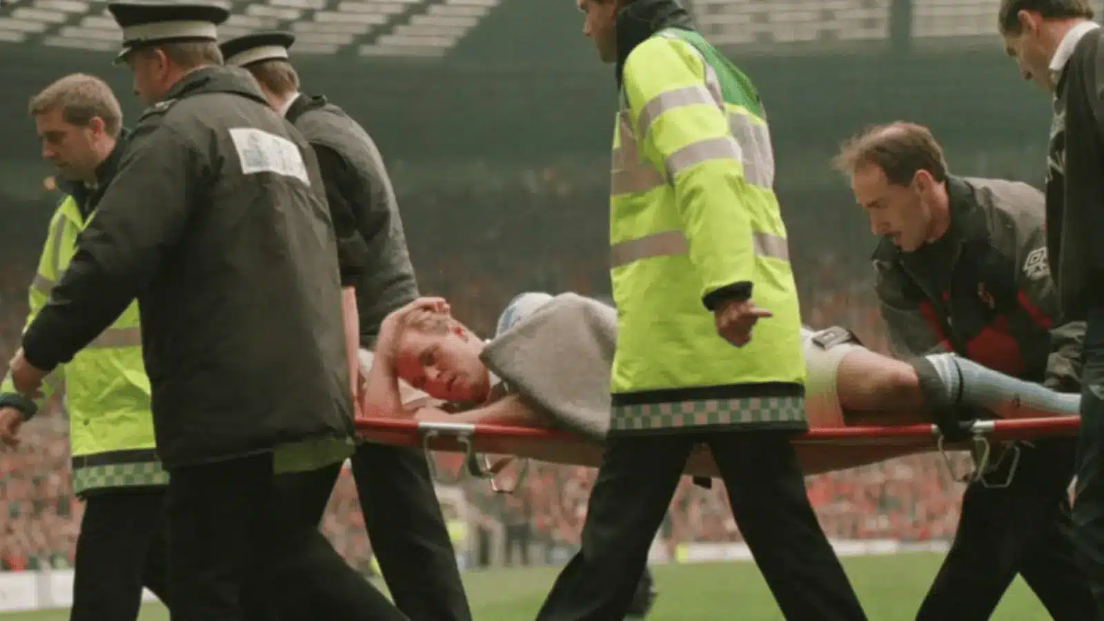 David Busst's Leg Break Football's Most Infamous Injury (2)