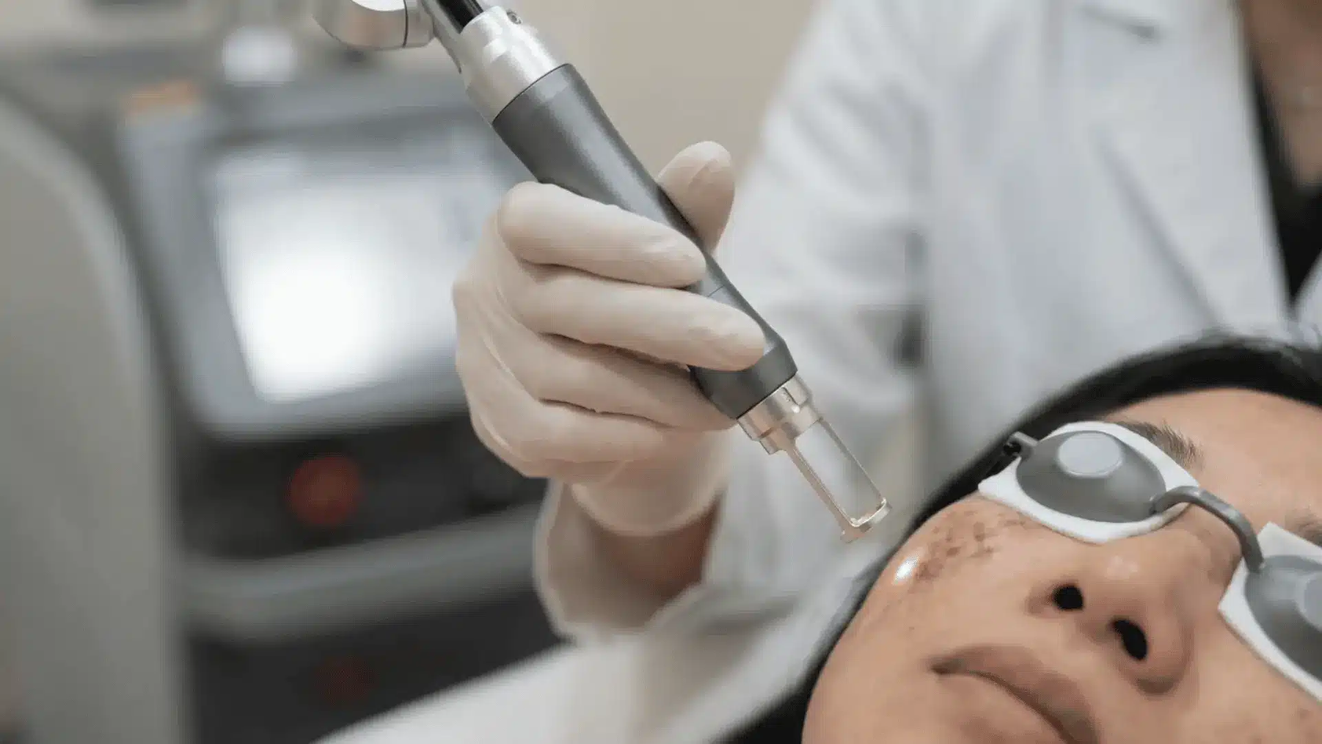 when-topicals-are-not-enough-professional-treatments-for-stubborn-dark-spots