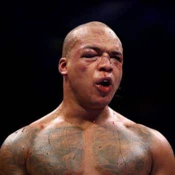 Fabio Wardley injured after Daniel Dubois fight, WBO heavyweight title bout