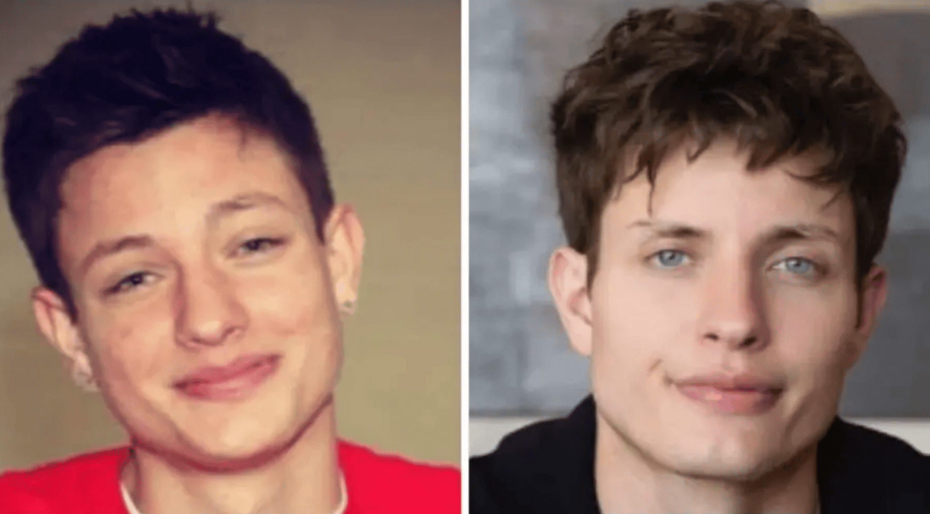 Before and after comparison of a man showing different hairstyles and facial appearances over time.