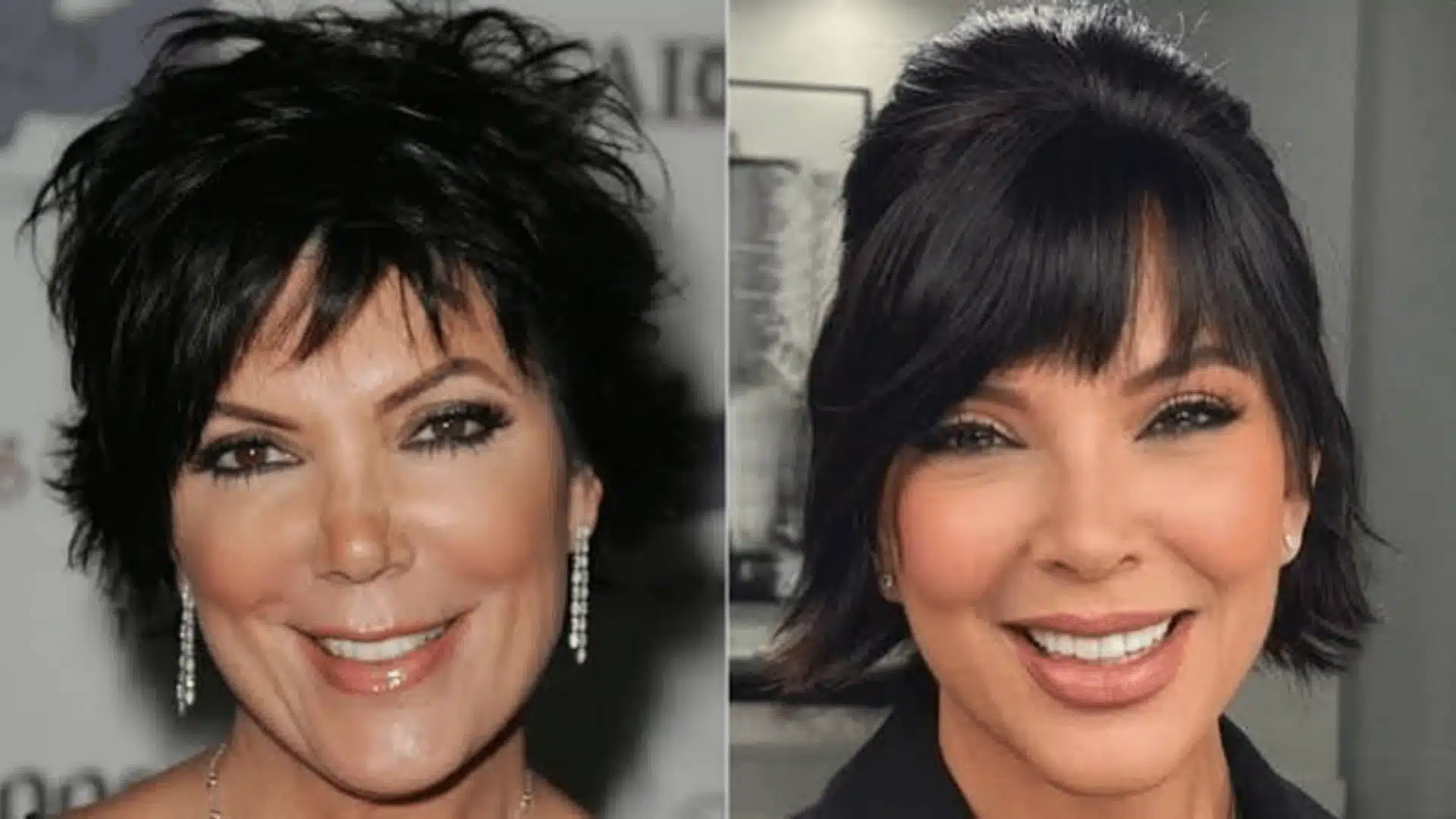 Kris Jenner before and after comparison showing changes in facial appearance and jawline over time.