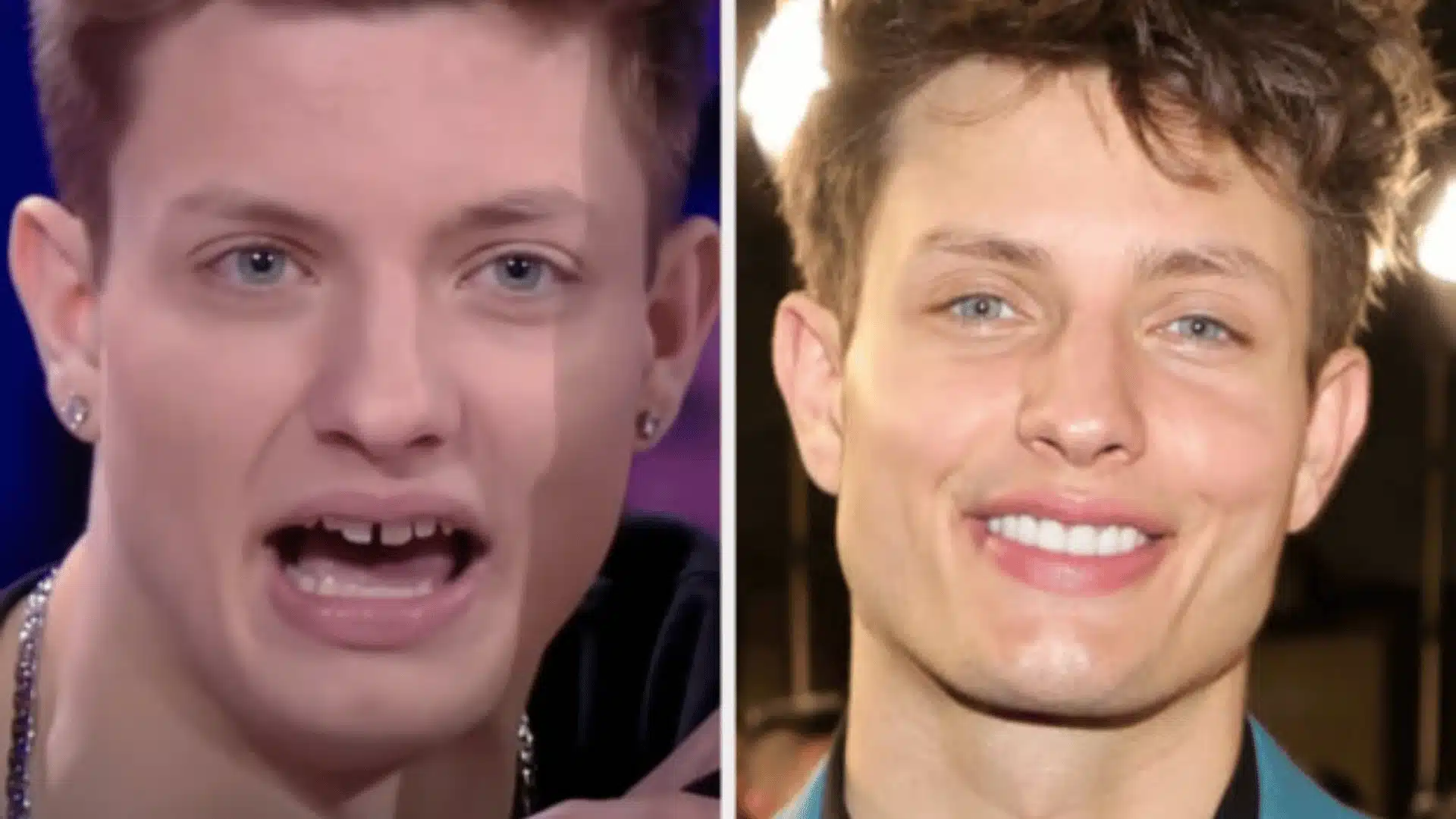Before and after comparison showing changes in a man's smile and facial appearance over time.