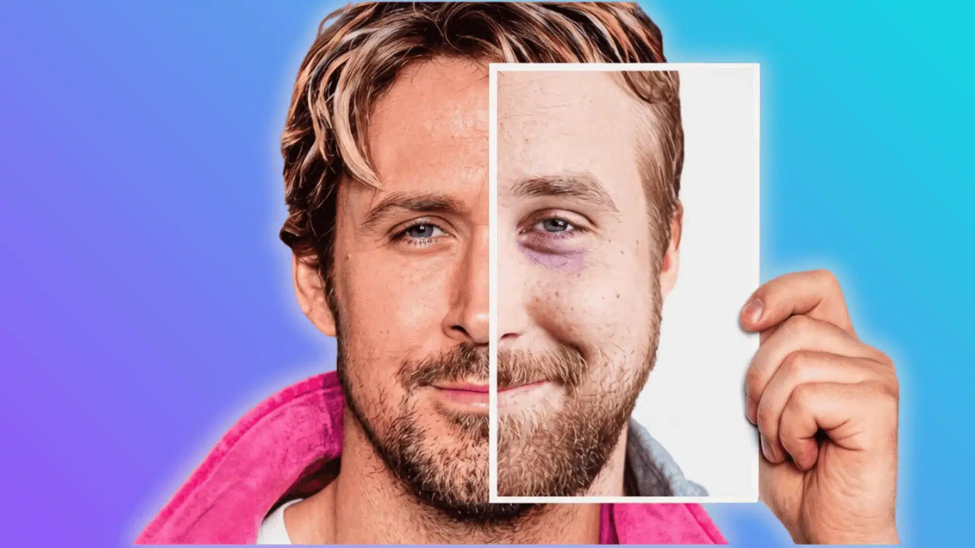 ryan-gosling-plastic-surgery-The-truth