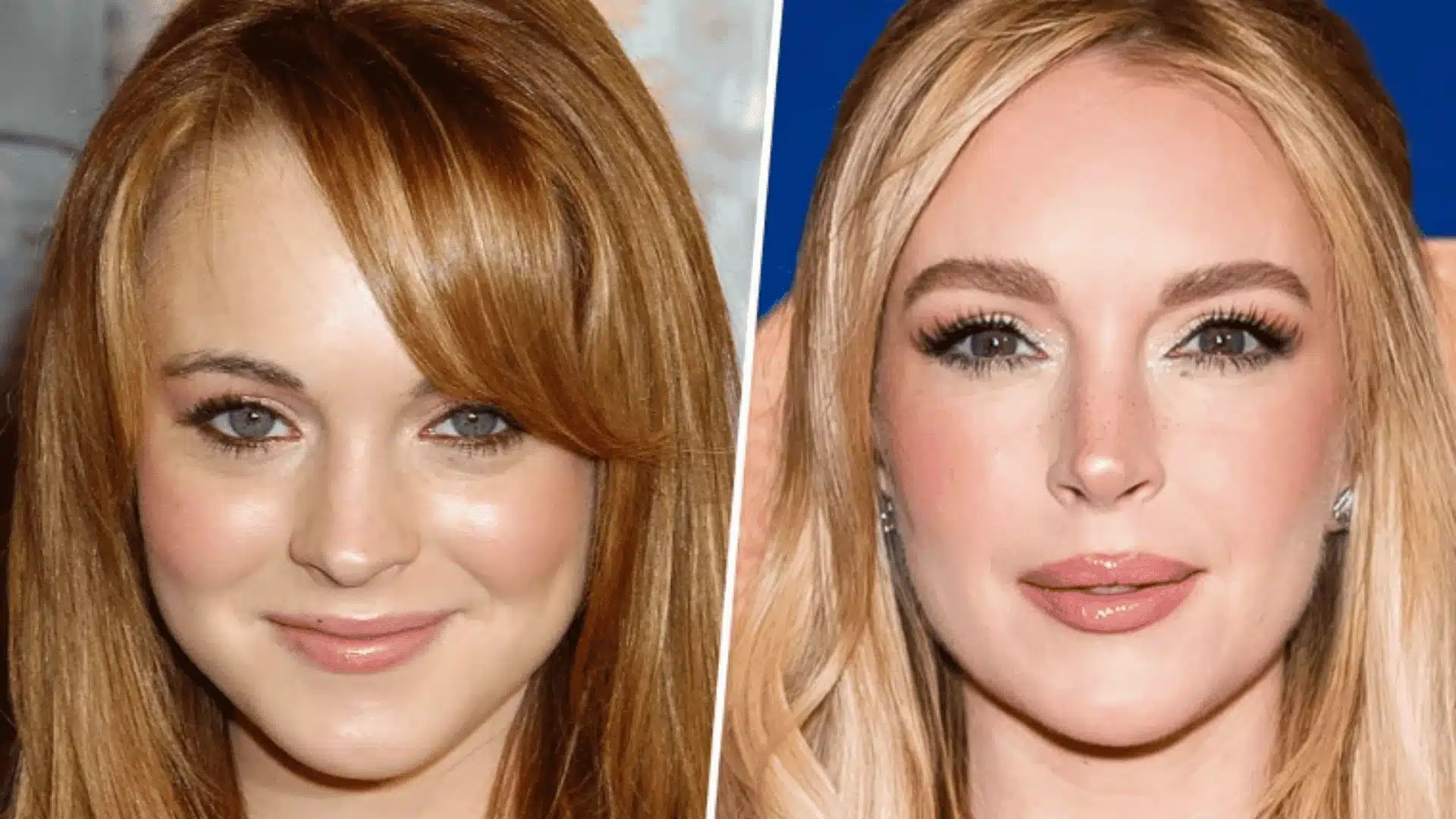 Before and after comparison showing Lindsay Lohan’s facial appearance changes over time in a plastic surgery discussion.