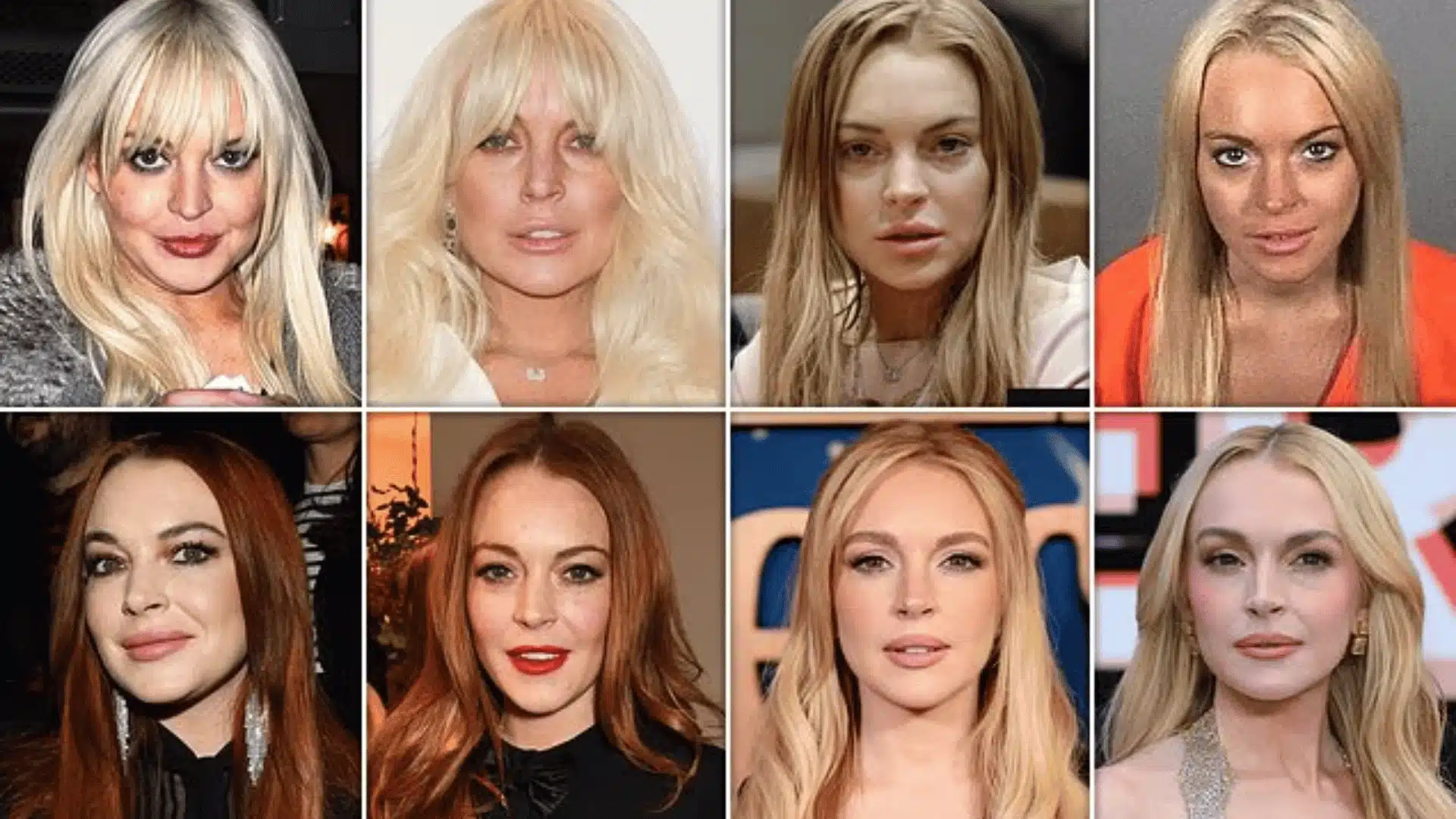 Collage showing Lindsay Lohan’s appearance changes across different years in a plastic surgery and transformation discussion.