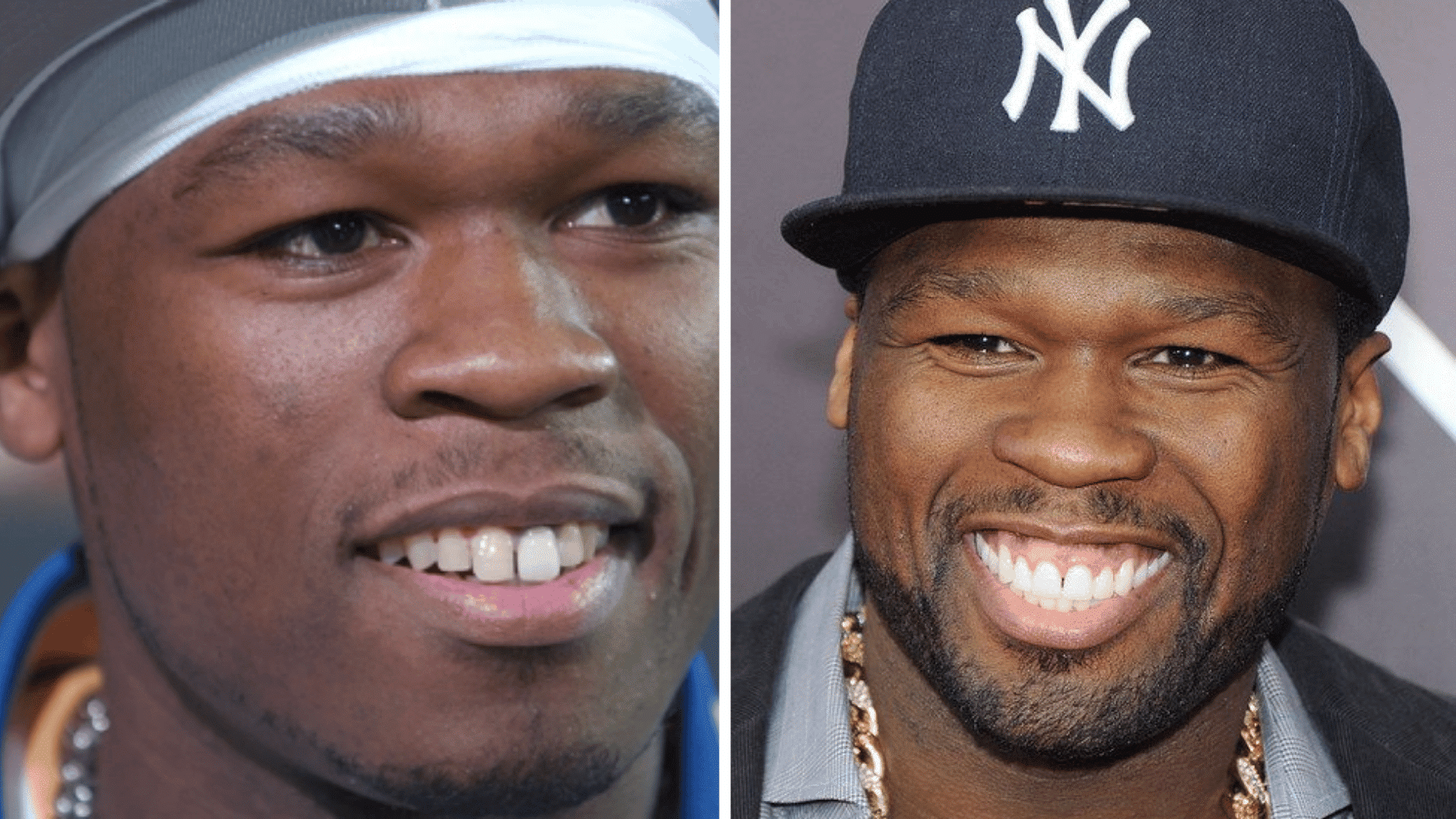 50 Cent before and after dental appearance comparison showing changes in his smile and teeth.