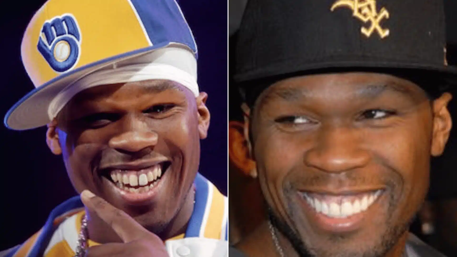 Three photos of 50 Cent showing uneven teeth, missing teeth in the center, and a complete aligned smile on the right