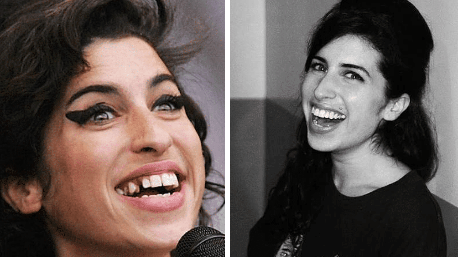 Amy Winehouse before and after dental appearance comparison showing changes in his smile and teeth.