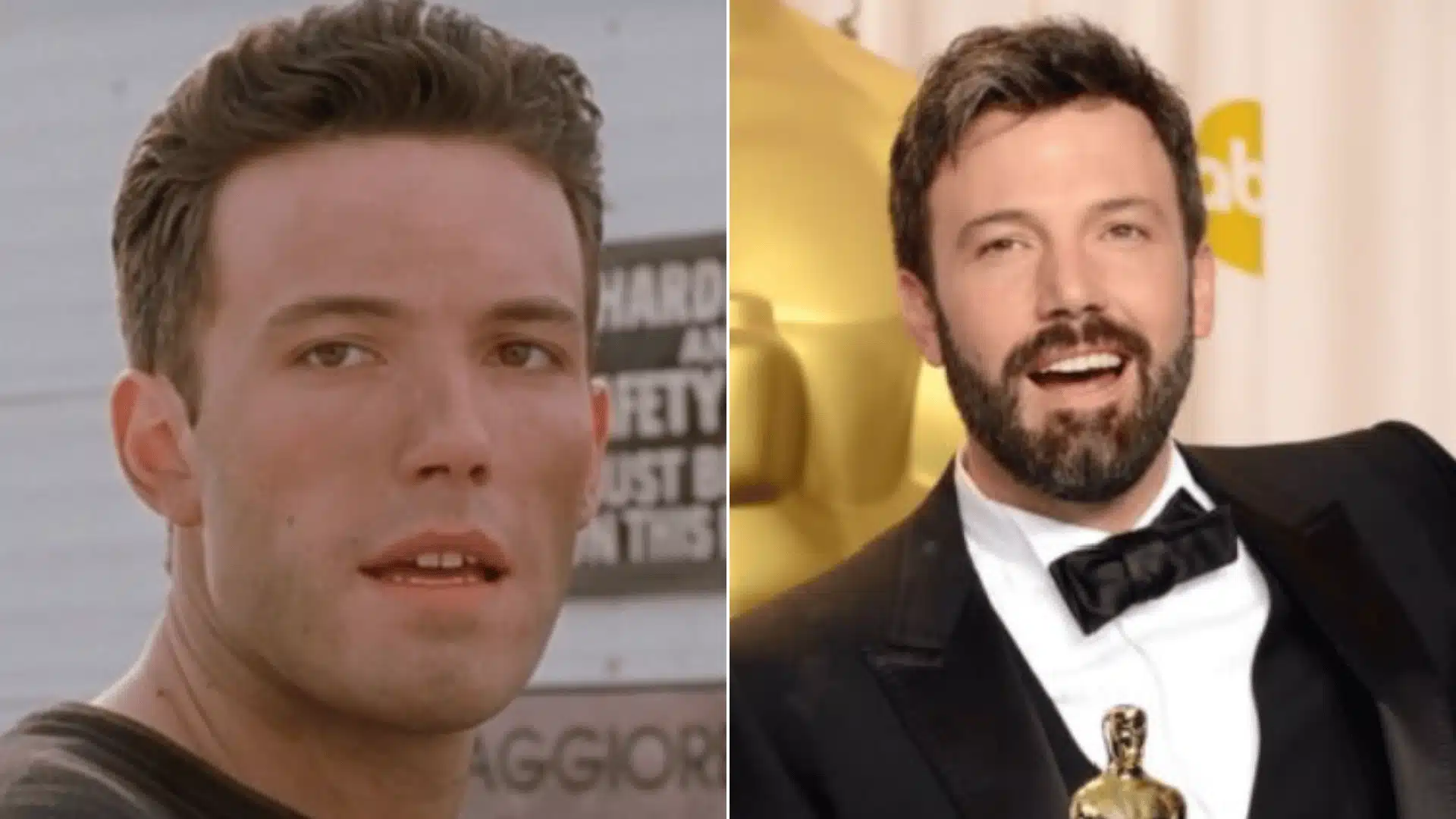 Ben Affleck smiling in a portrait on the left and an adult headshot with straighter upper teeth on the right