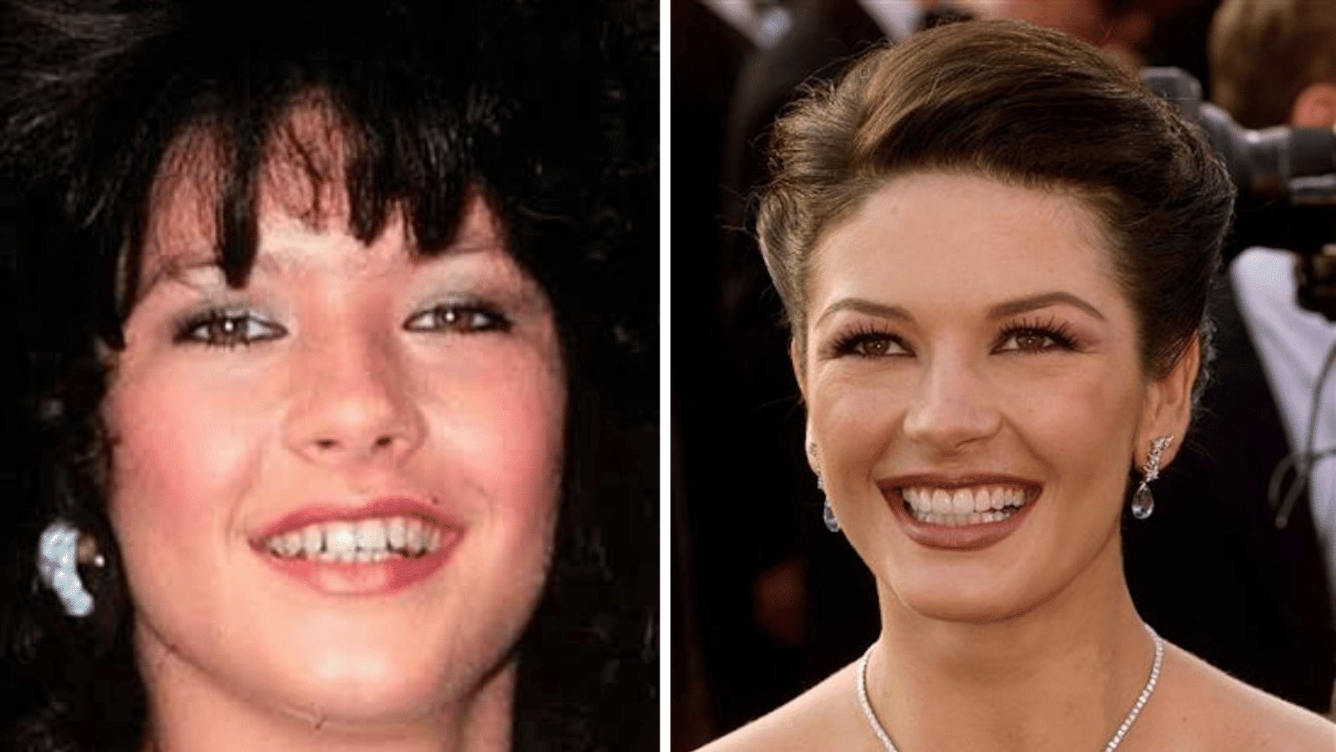 Catherine Zeta Jones before and after dental appearance comparison showing changes in his smile and teeth.