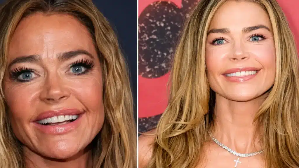 celebrity-plastic-surgery-confirmed-procedures-&-facts