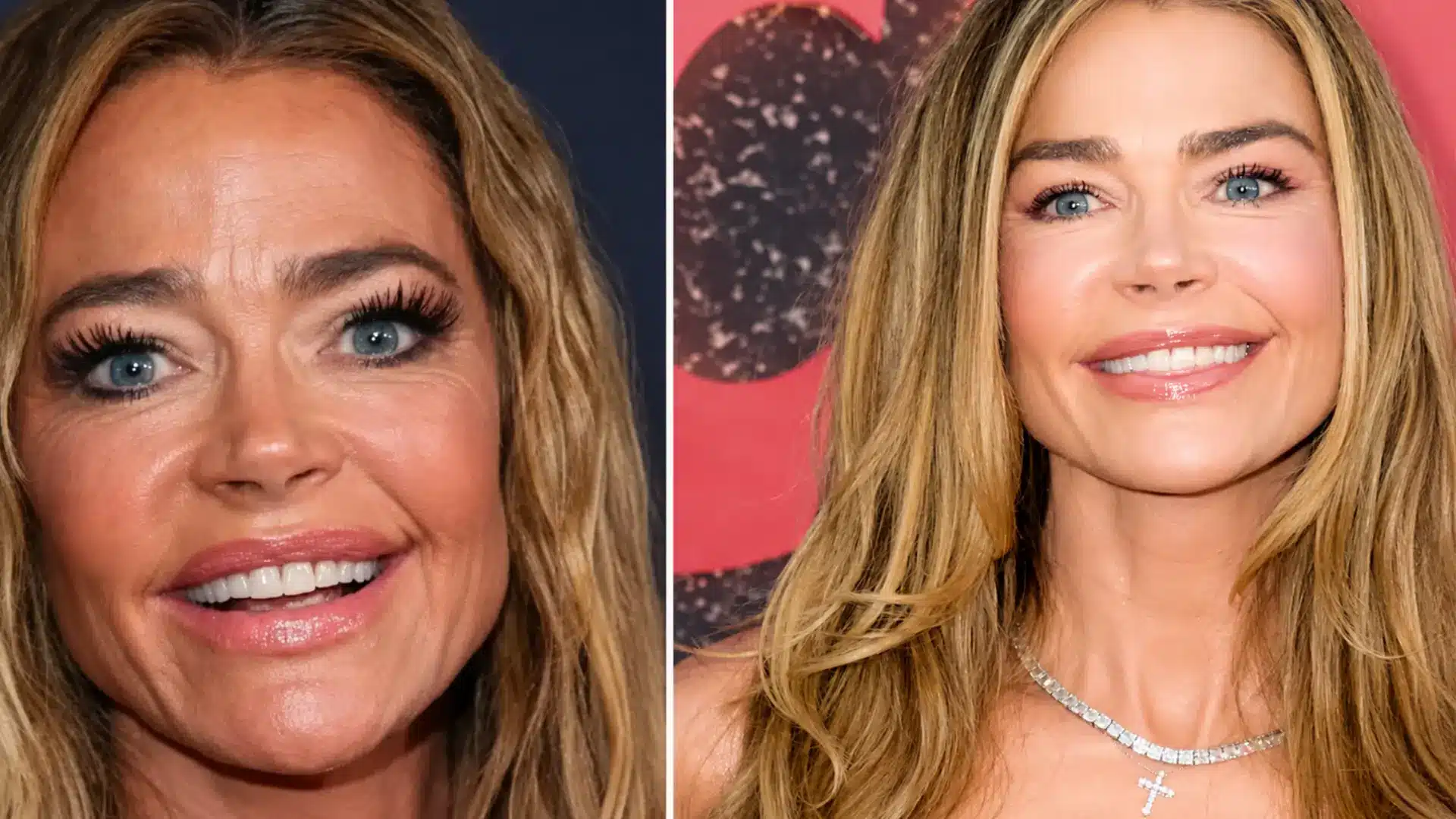 celebrity-plastic-surgery-confirmed-procedures-&-facts