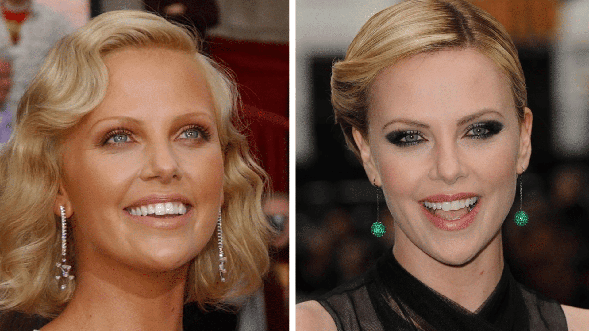 Charlize Theron before and after dental appearance comparison showing changes in his smile and teeth.