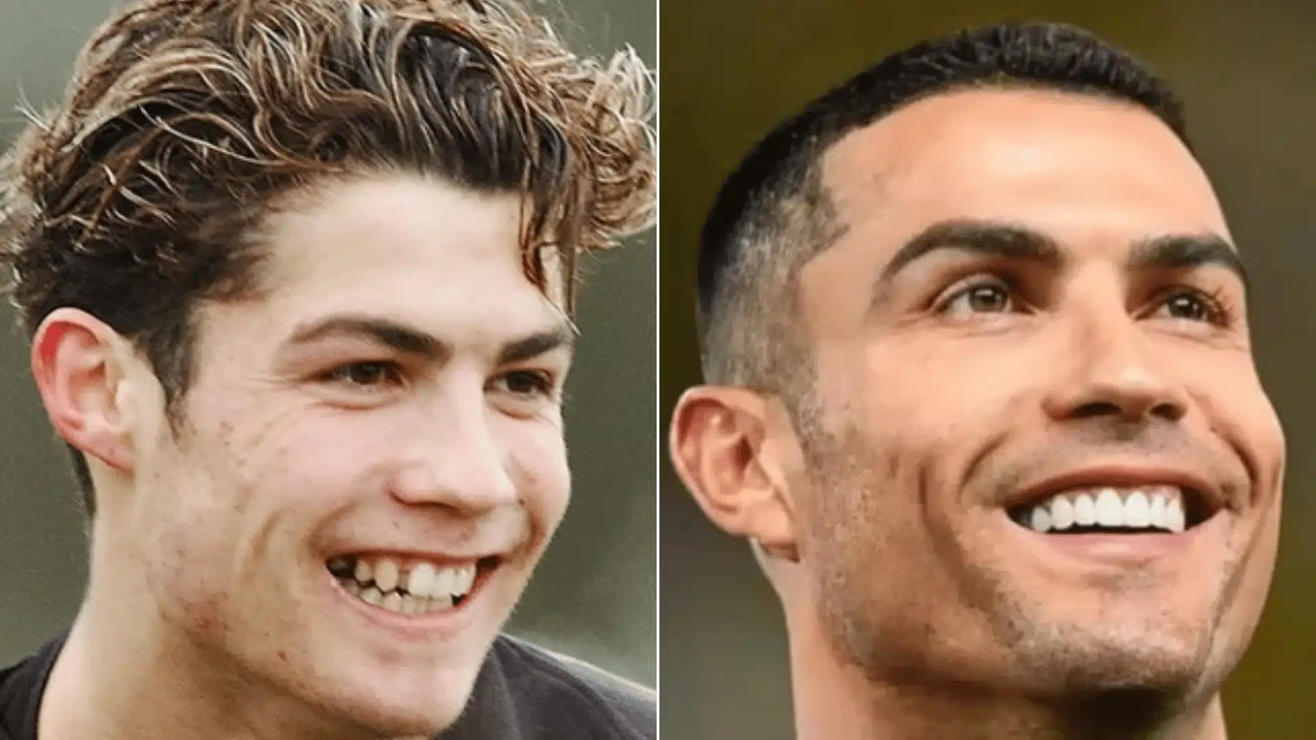 Cristiano Ronaldo smiling in two portraits, with a prominent upper front tooth on the left and an even tooth line on the right
