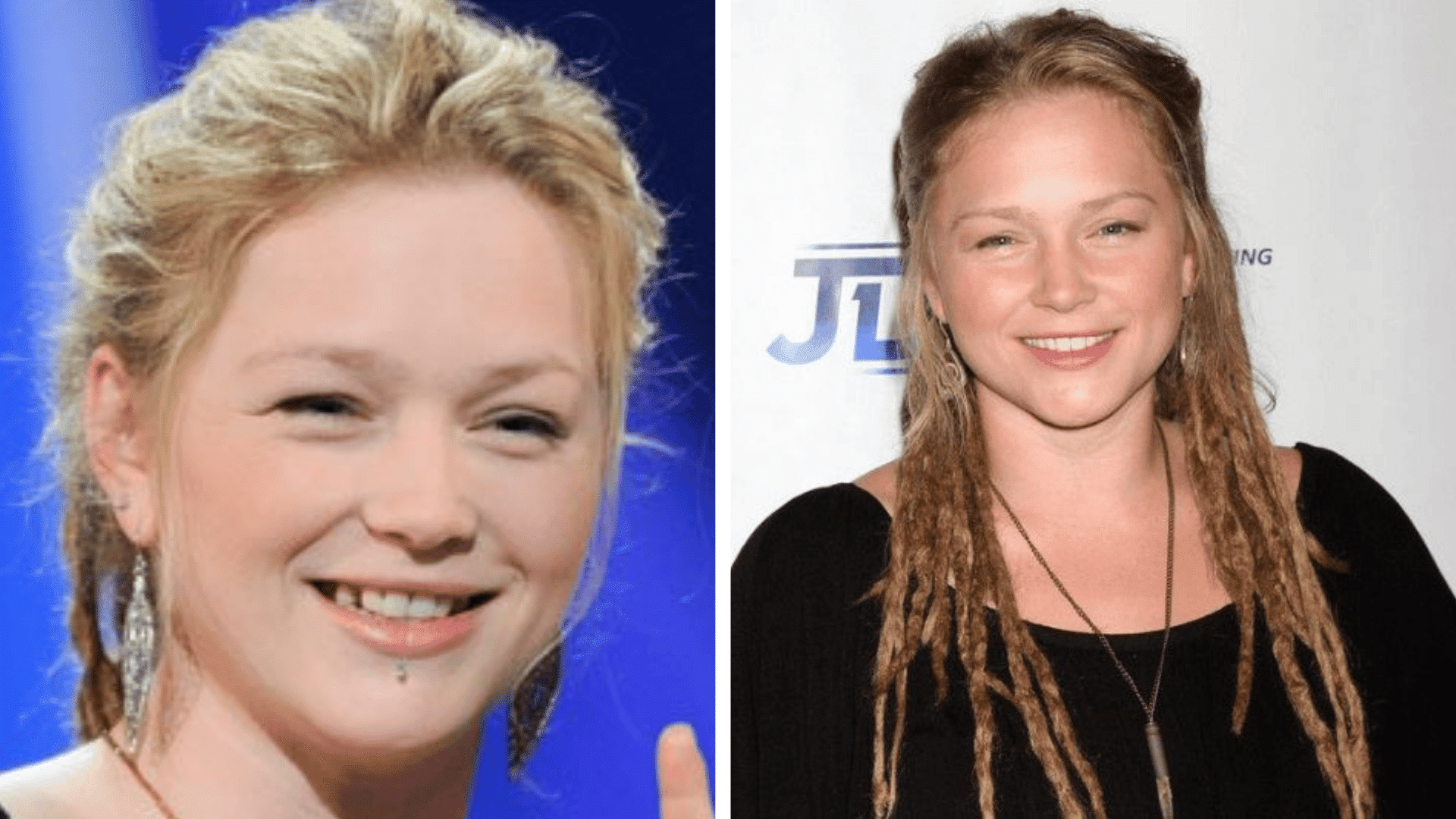 Crystal Bowersox before and after dental appearance comparison showing changes in his smile and teeth.