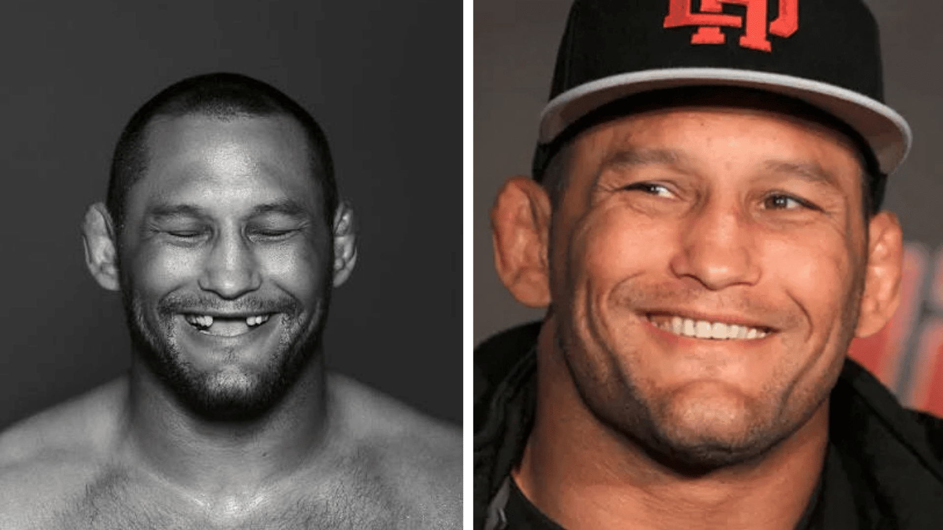 Dan Henderson before and after dental appearance comparison showing changes in his smile and teeth.