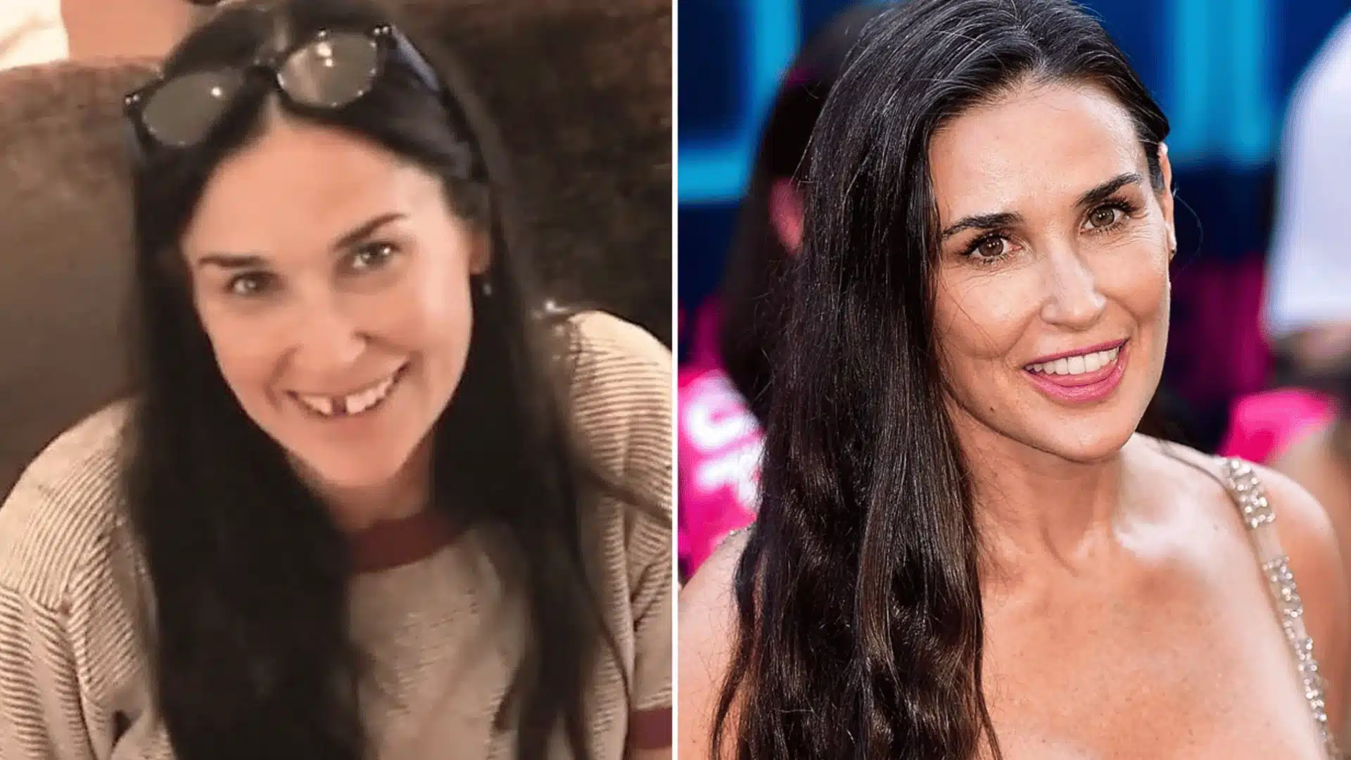 Demi Moore with a missing upper front tooth on the left and a complete tooth line on the right