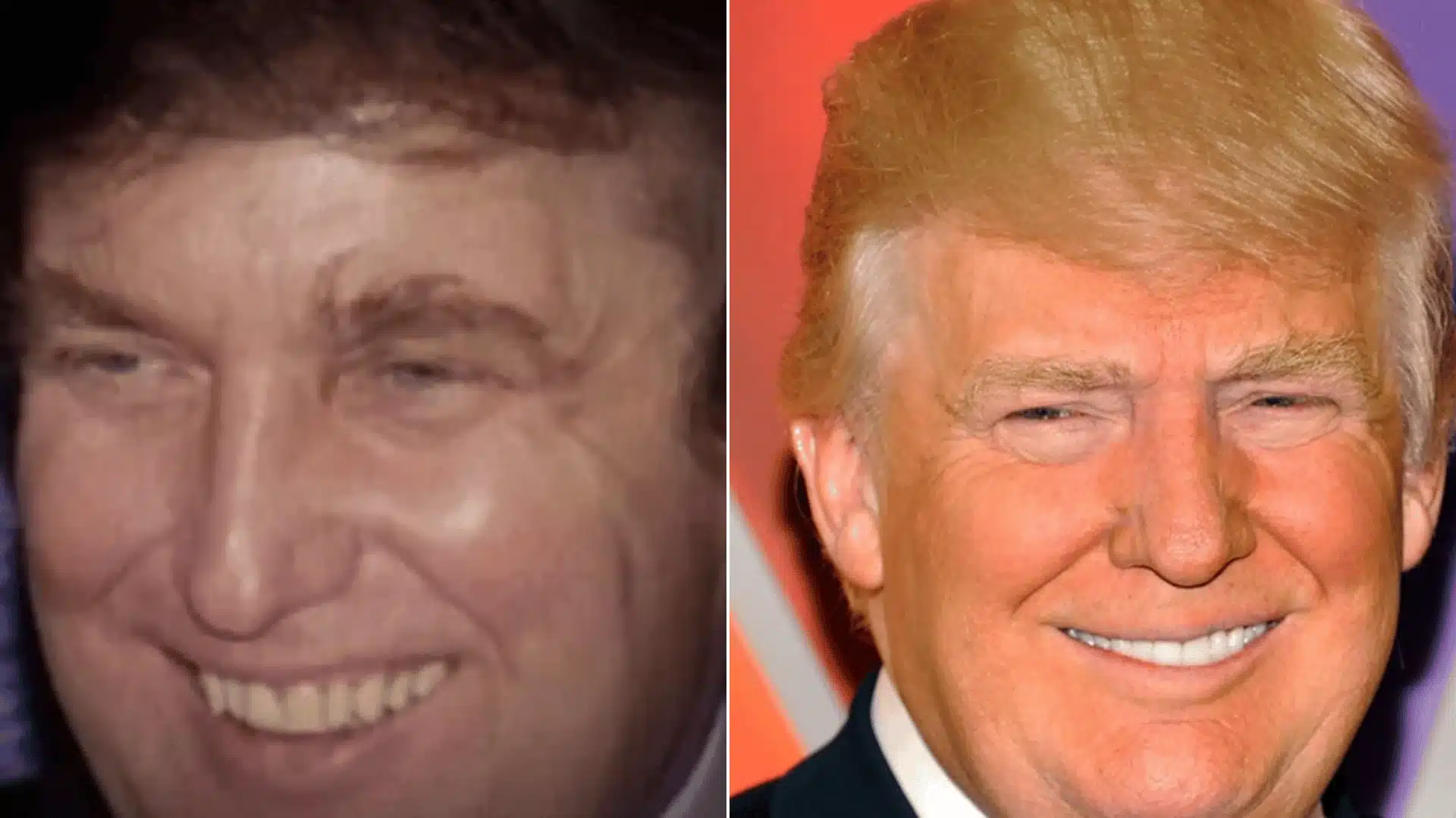 Side-by-side portraits of Donald Trump smiling, with shorter teeth on the left and brighter, more even teeth on the right