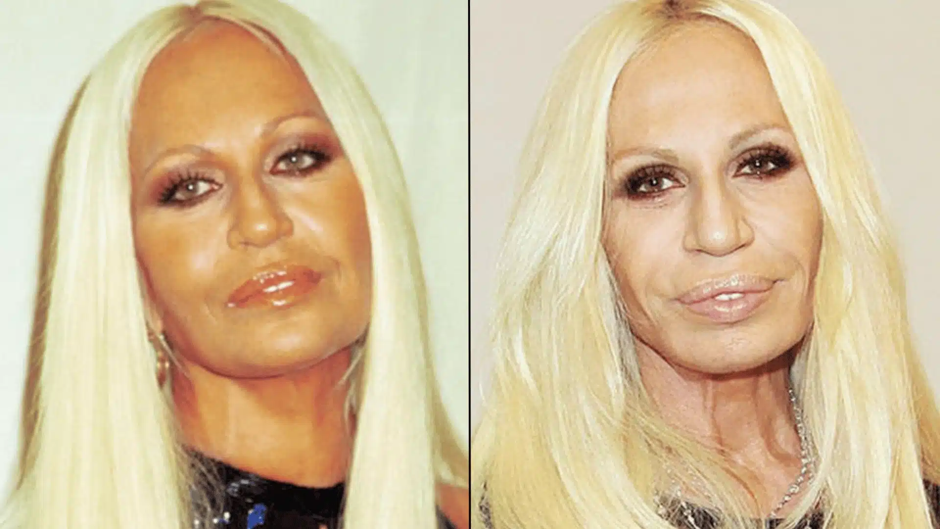 Donatella Versace before-and-after face comparison, showing her appearance in two different time periods.