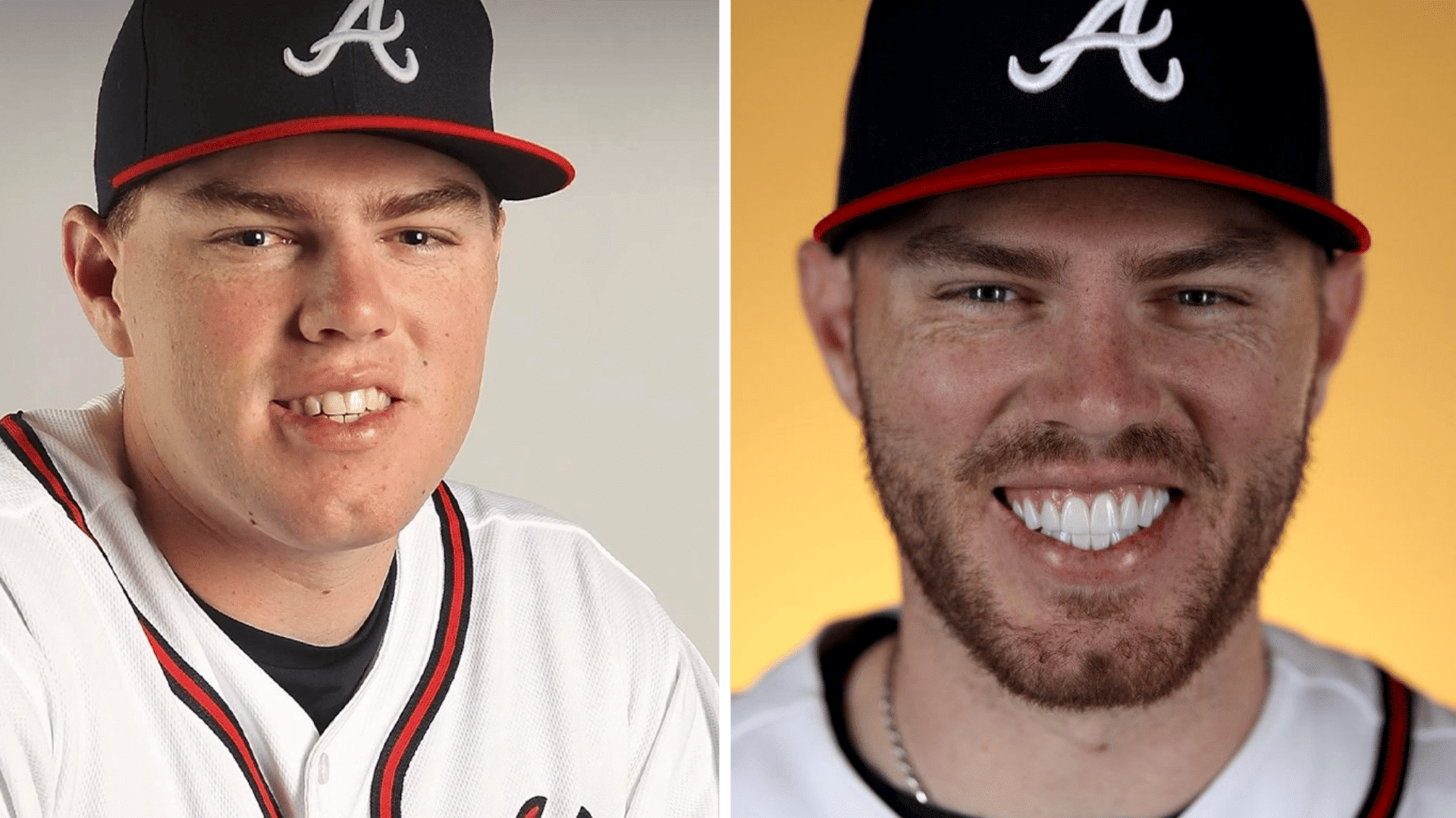 Freddie Freeman before and after dental appearance comparison showing changes in his smile and teeth.