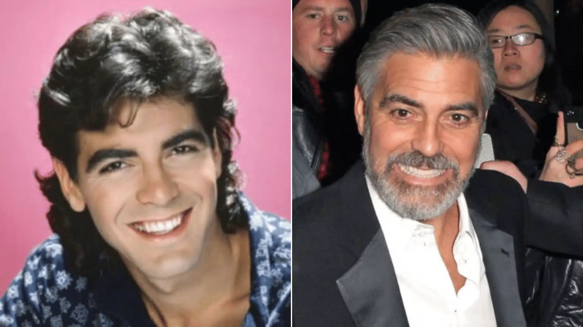 George Clooney smiling in portraits, with shorter yellow-toned teeth before and longer white teeth after