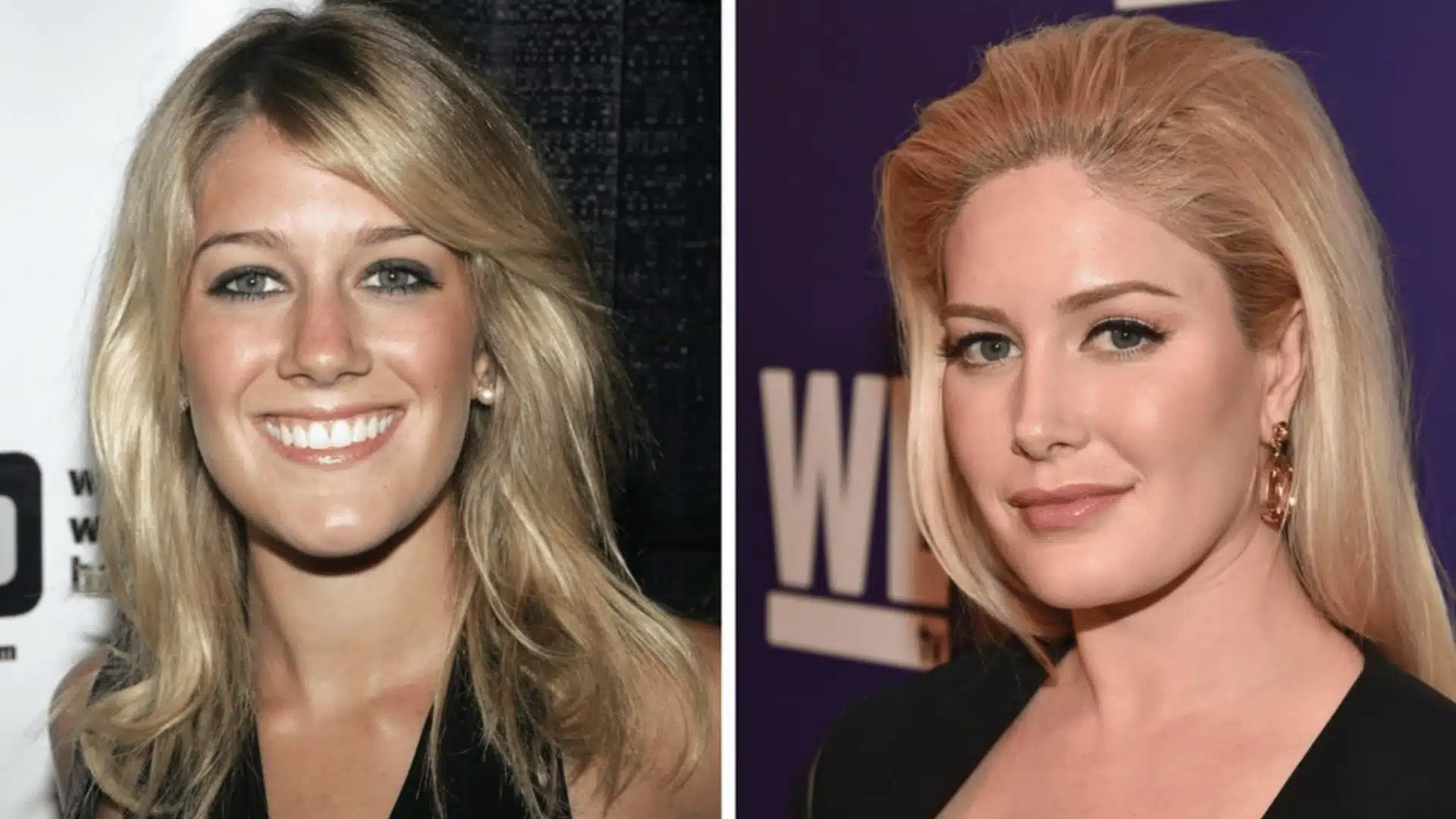 Heidi Montag before-and-after face comparison, showing her appearance in two different time periods.
