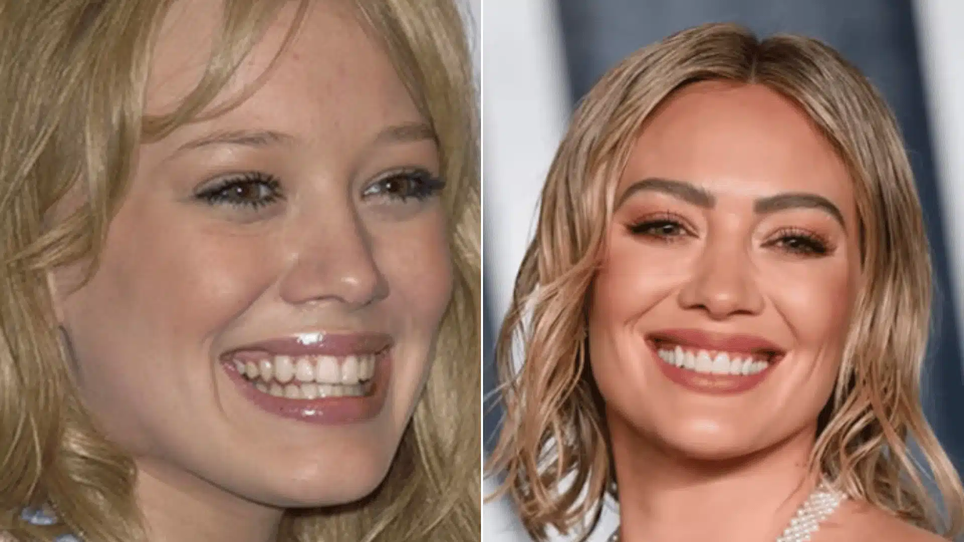 Hilary Duff smiling in two portraits, with longer front teeth on the left and shorter, rounder teeth on the right