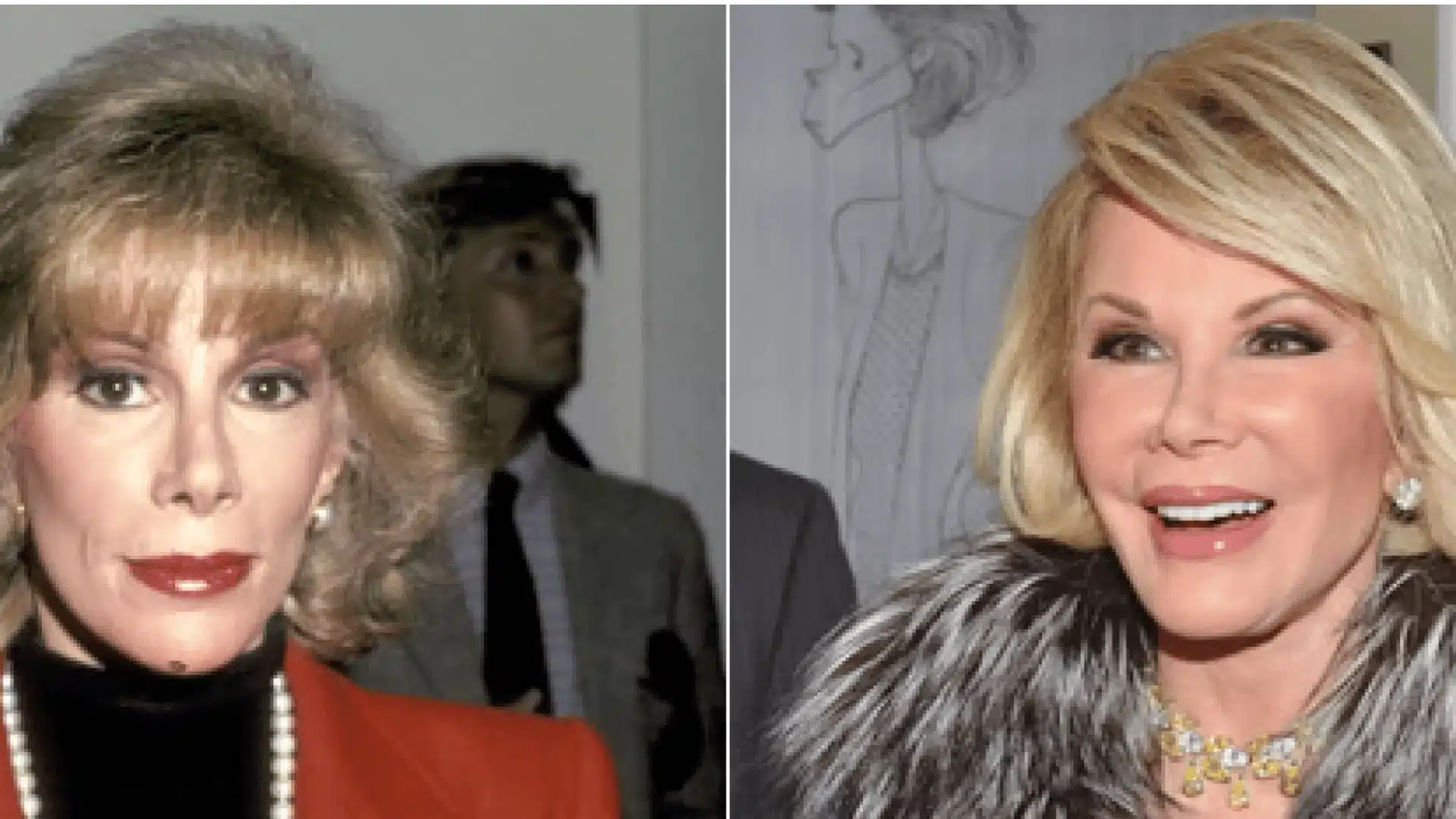 Joan Rivers before-and-after face comparison, showing her appearance in two different time periods.
