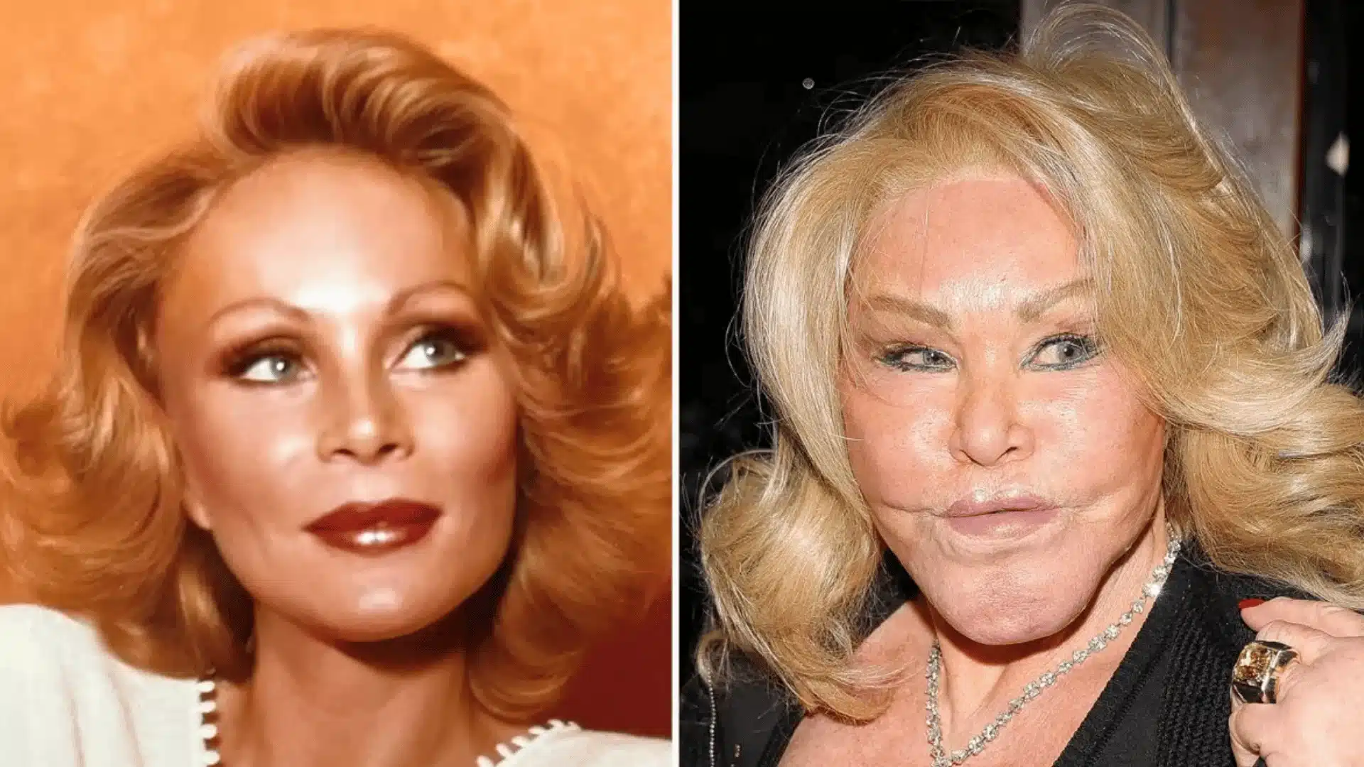 Jocelyn Wildenstein before-and-after face comparison, showing her appearance in two different time periods.