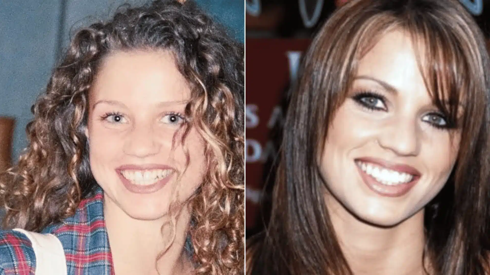 Katie Price smiling in portraits, with rounded teeth first and larger, squarer teeth later