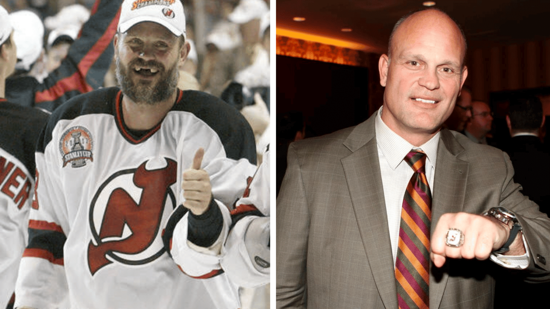Ken Daneyko before and after dental appearance comparison showing changes in his smile and teeth.