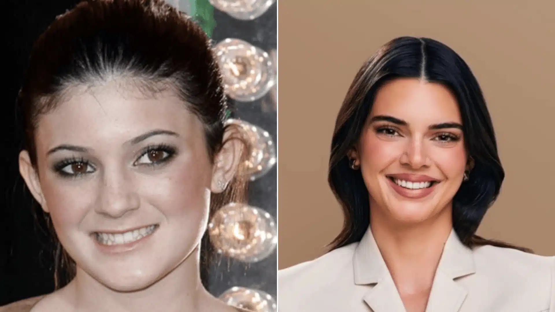 Kendall Jenner wearing braces in the left portrait and smiling without braces in the right portrait