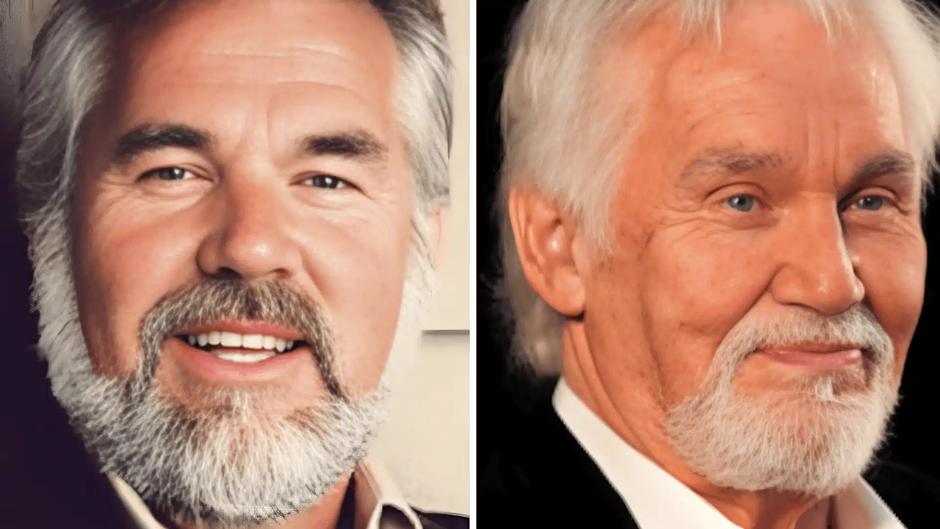 Kenny Rogers before-and-after face comparison, showing his appearance in two different time periods.