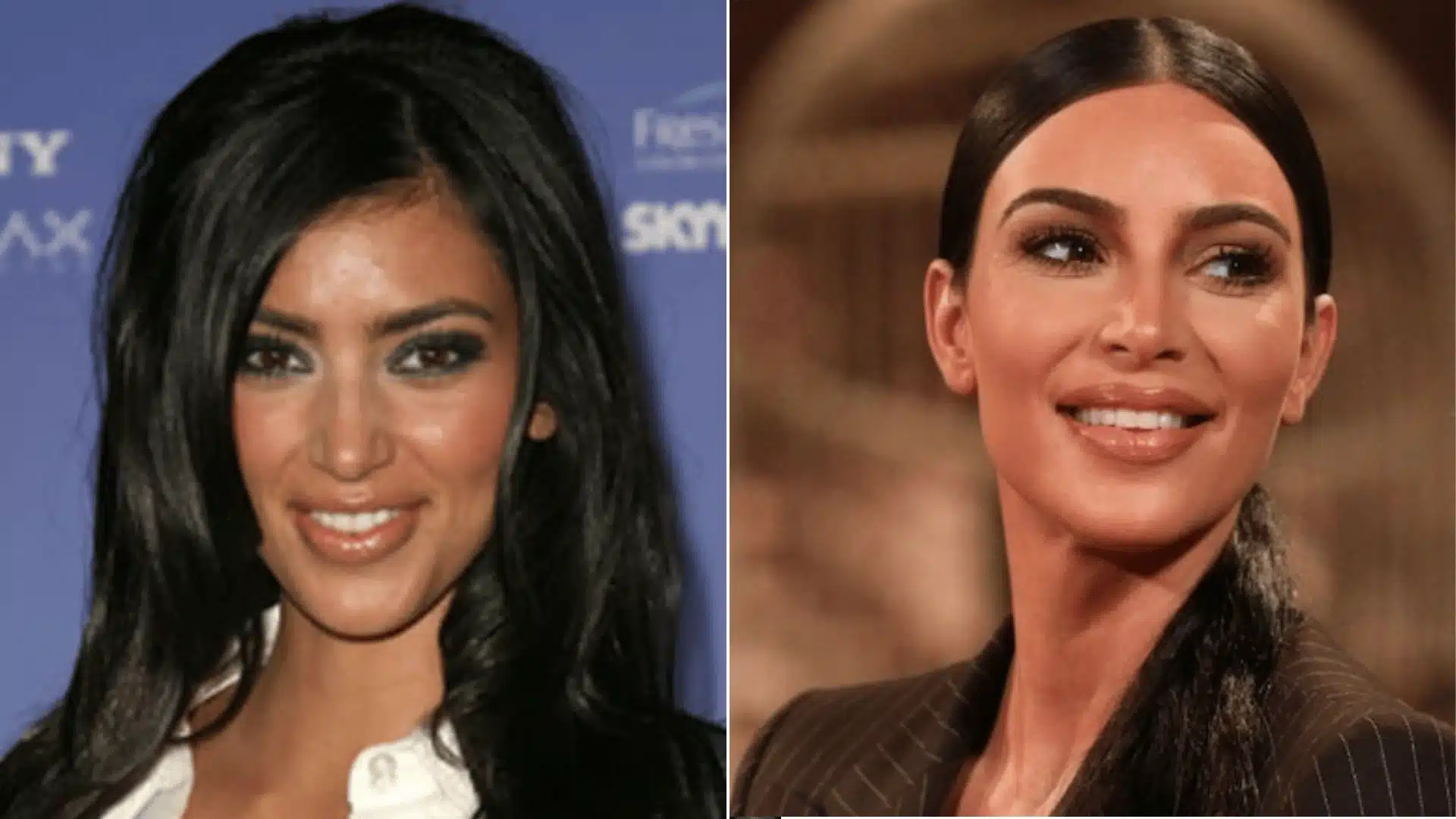 Kim Kardashian in two portraits, with darker, less uniform teeth on the left and a brighter, more even smile on the right