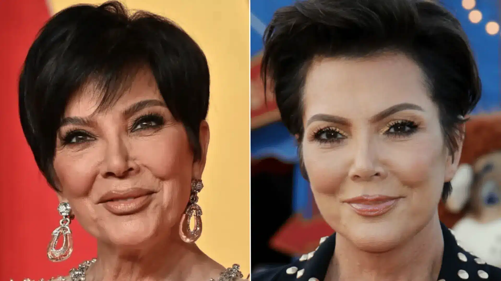 Kris Jenner at a public event, featured in a discussion of her confirmed facelift surgery.