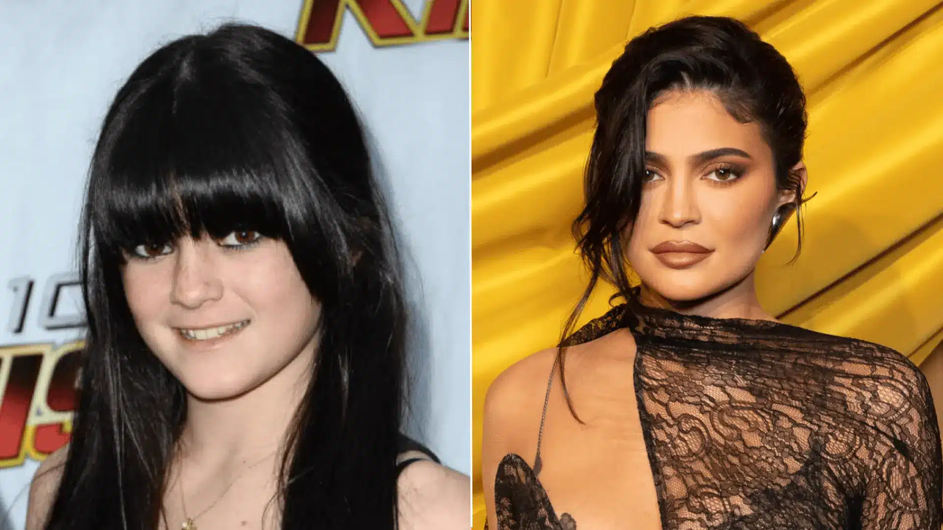 Kylie Jenner at a public event, discussed in relation to confirmed cosmetic procedures and disputed surgery rumors.