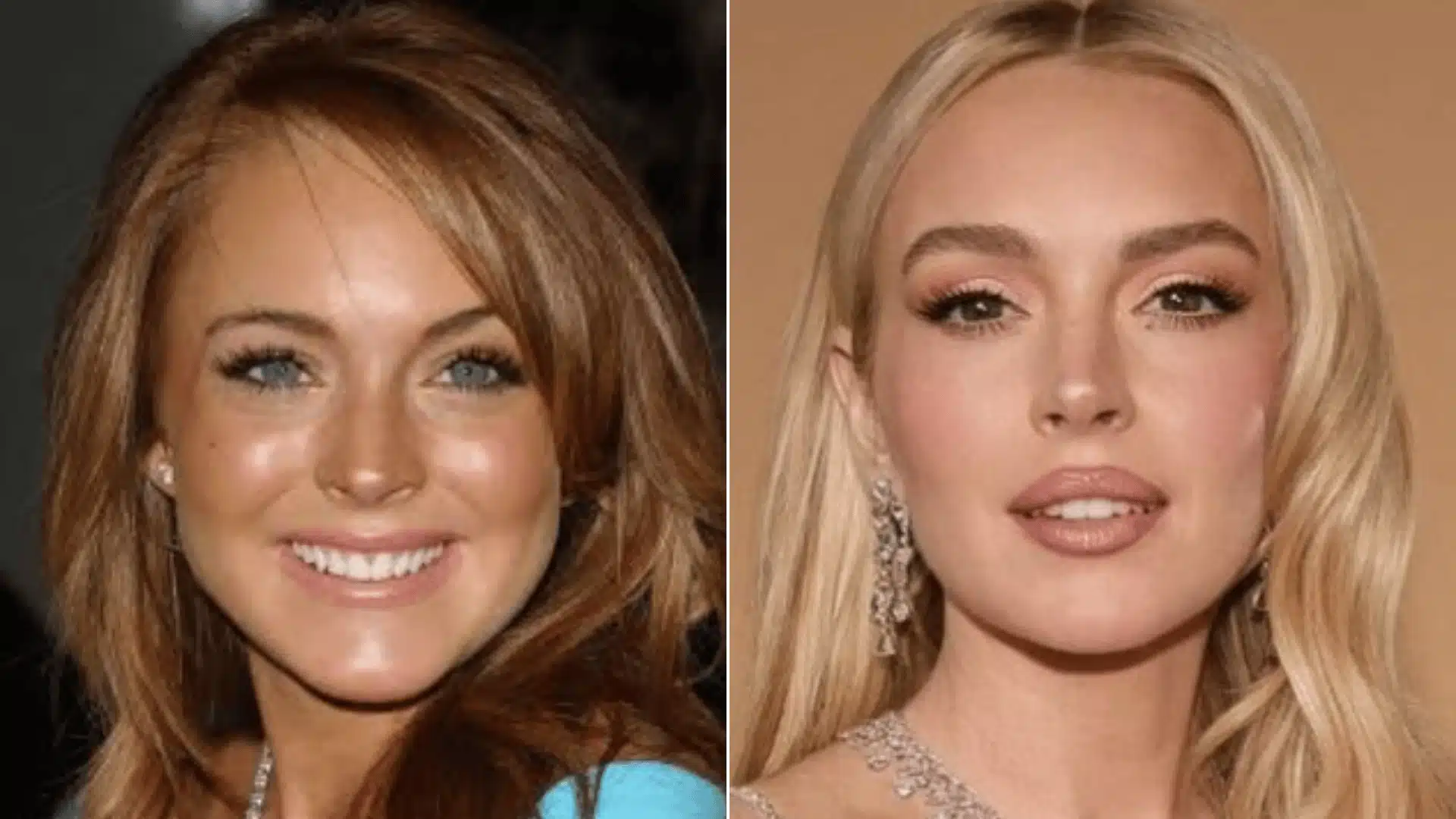 Lindsay Lohan in paired portraits, with uneven upper teeth on the left and a brighter, more uniform smile on the right