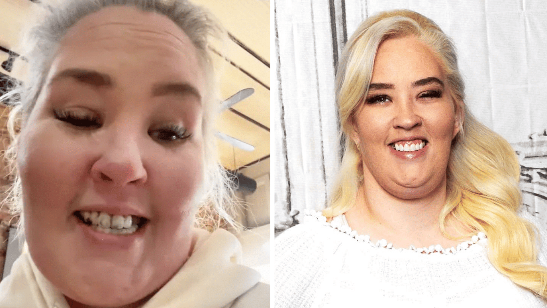 Mama June before and after dental appearance comparison showing changes in his smile and teeth.