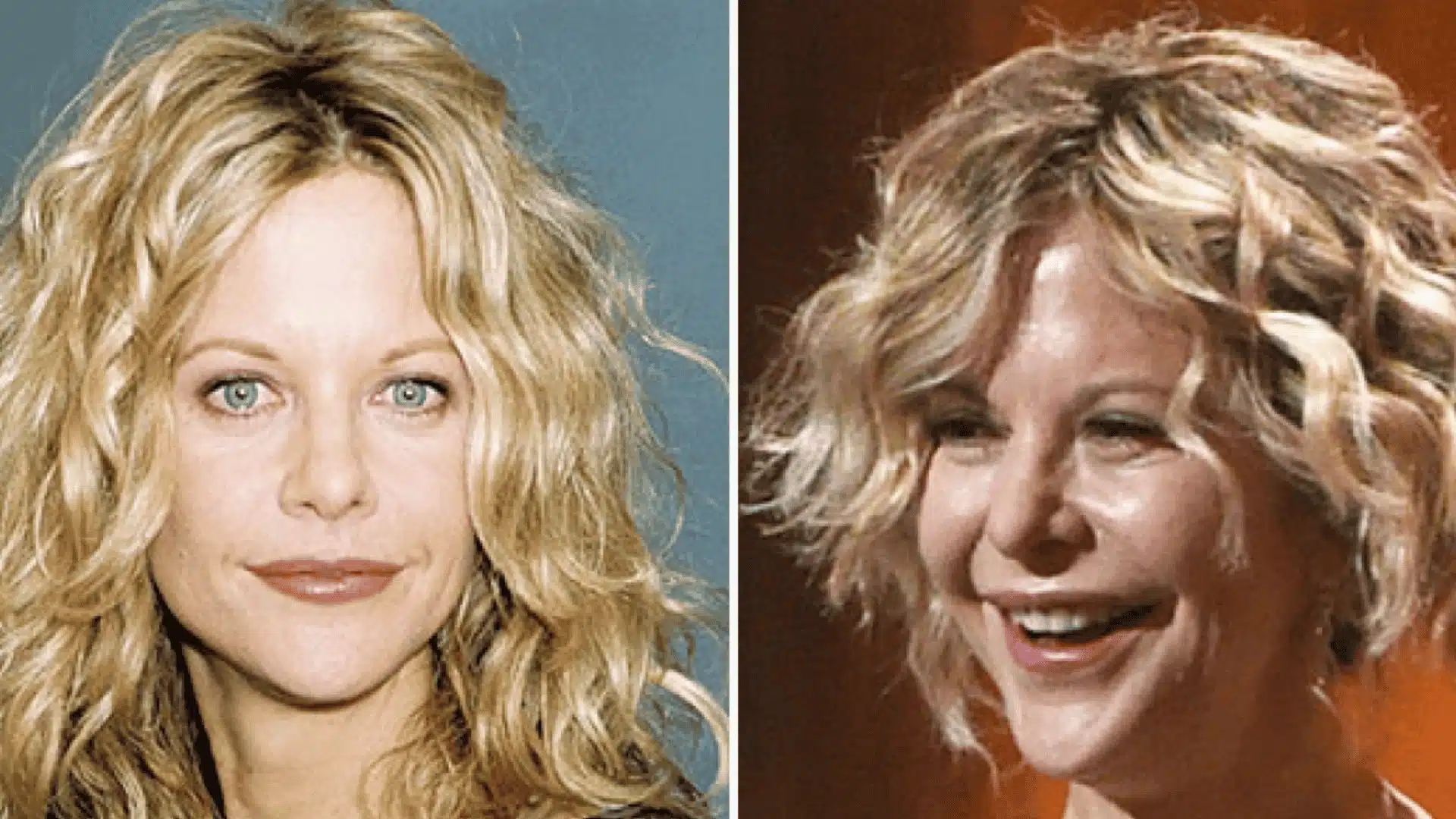 Meg Ryan before-and-after face comparison, showing her appearance in two different time periods.