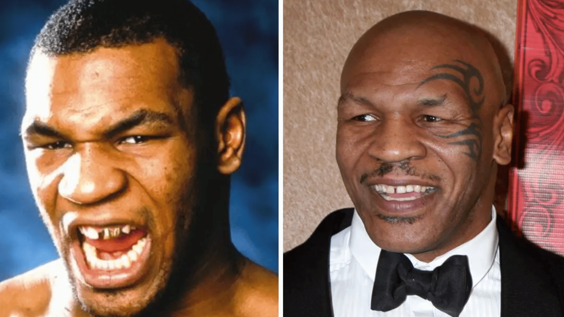 Mike Tyson before and after dental appearance comparison showing changes in his smile and teeth.