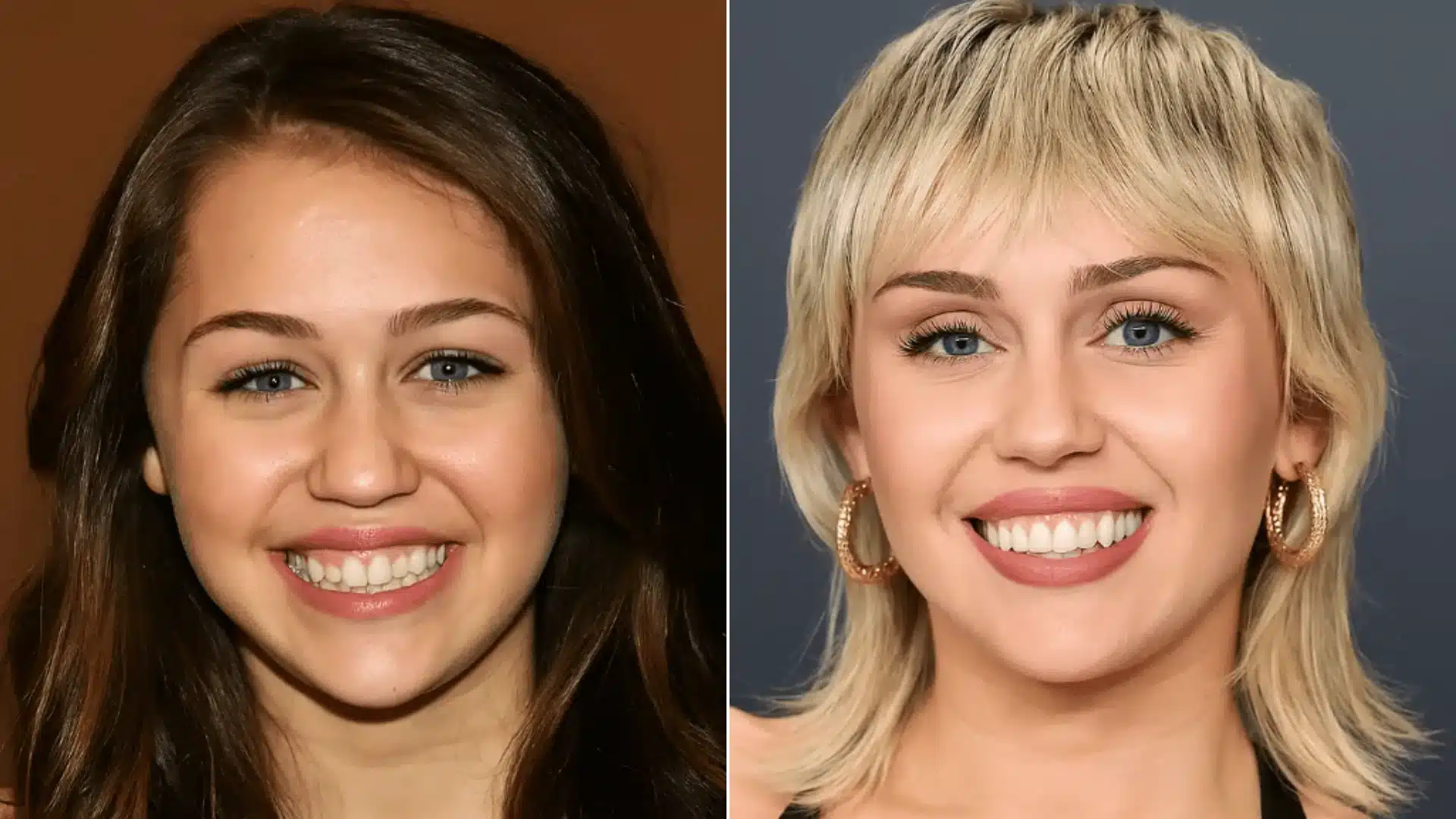 Miley Cyrus in paired portraits, with smaller rounded teeth on the left and broader, more evenly shaped teeth on the right