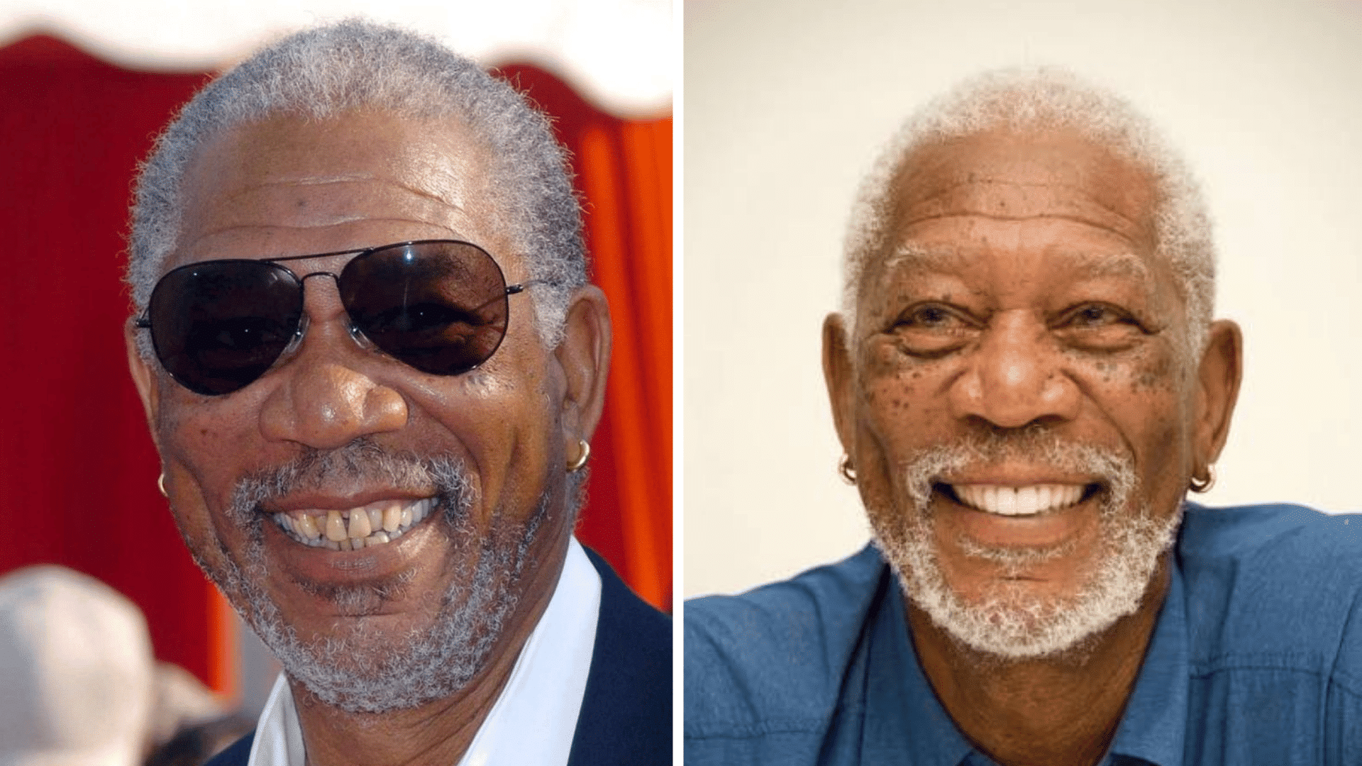 Morgan Freeman before and after dental appearance comparison showing changes in his smile and teeth.