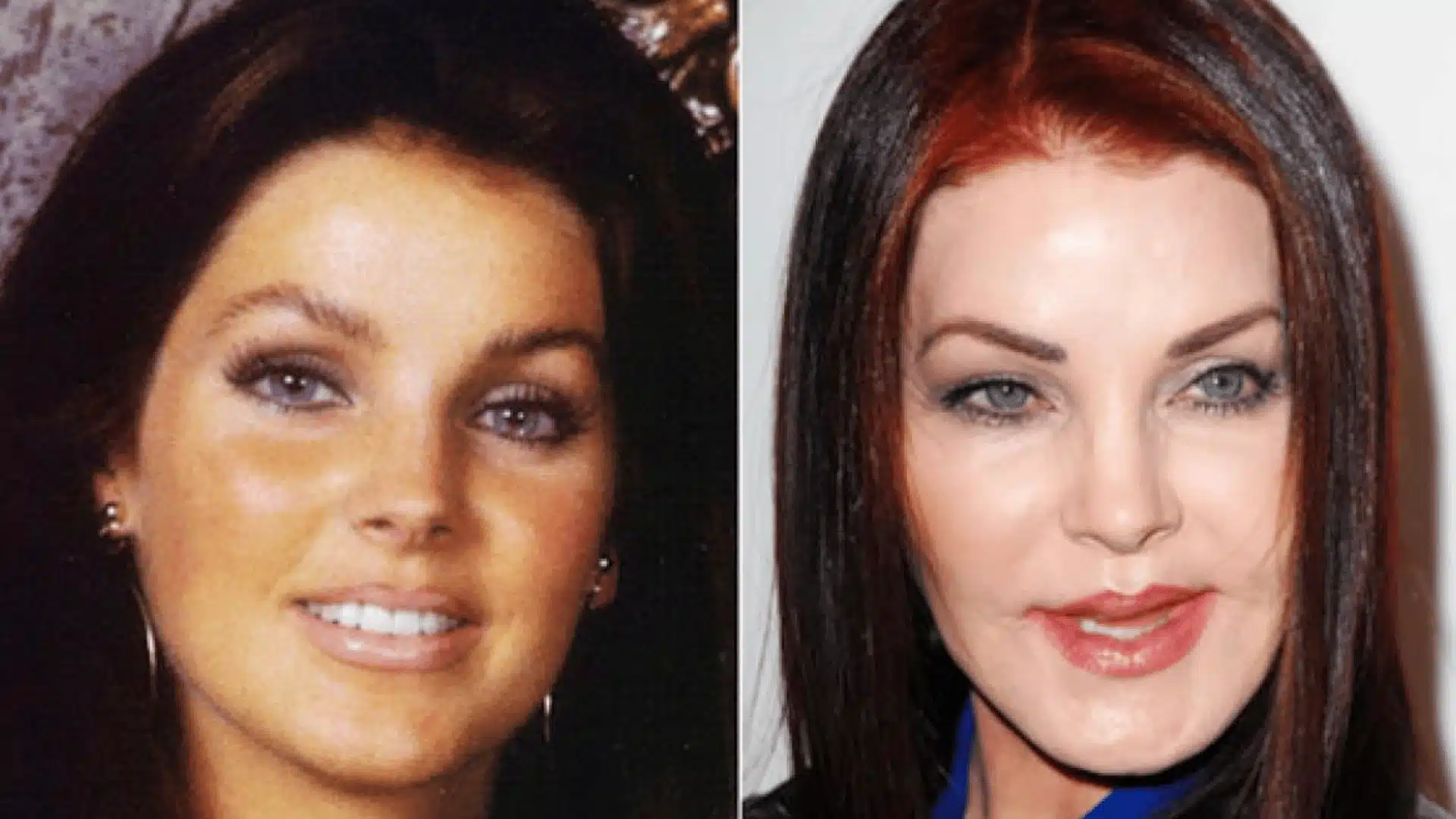 Priscilla Presley before-and-after face comparison, showing her appearance in two different time periods.