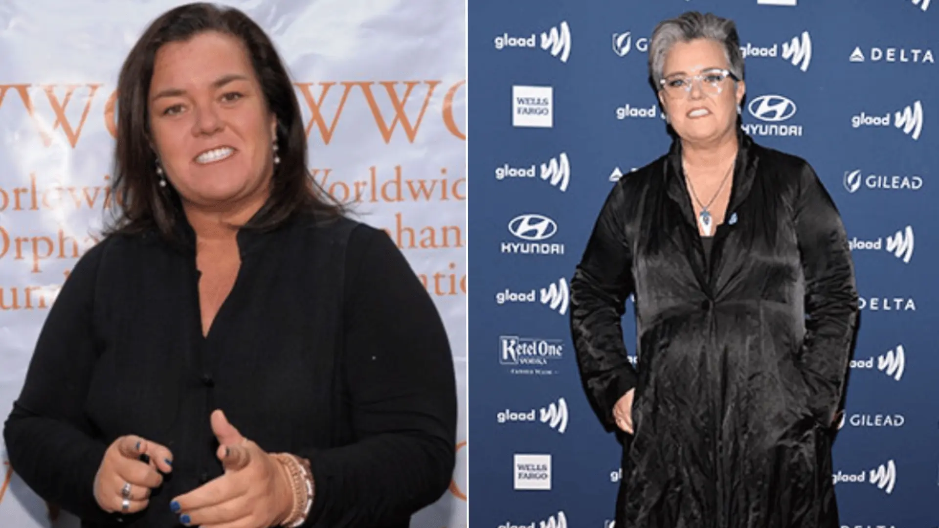 Rosie O’Donnell at a public event, featured in a discussion of her confirmed facelift surgery.