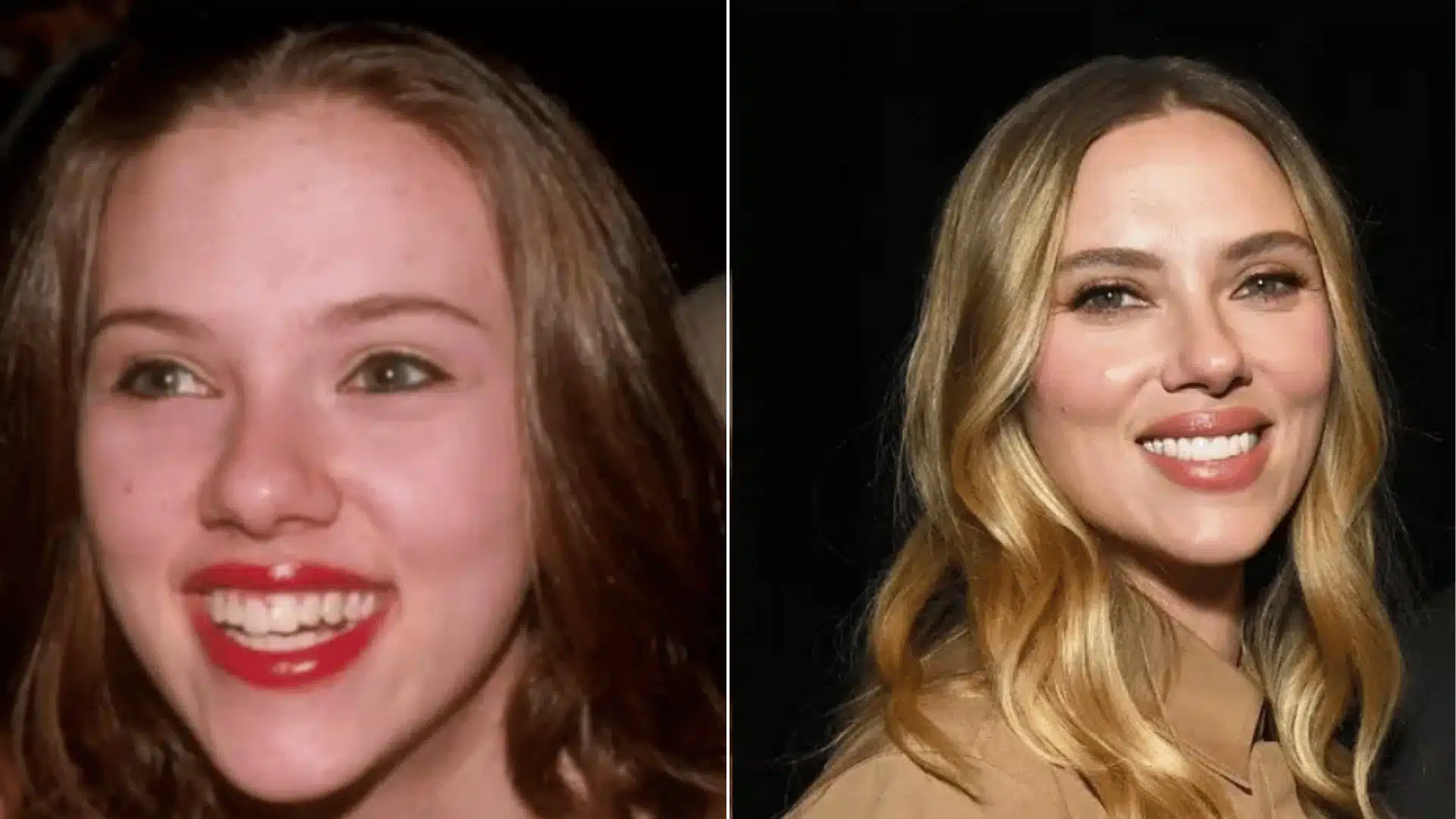 Scarlett Johansson smiling in paired portraits, with uneven upper-tooth spacing on the left and a more uniform smile on the right