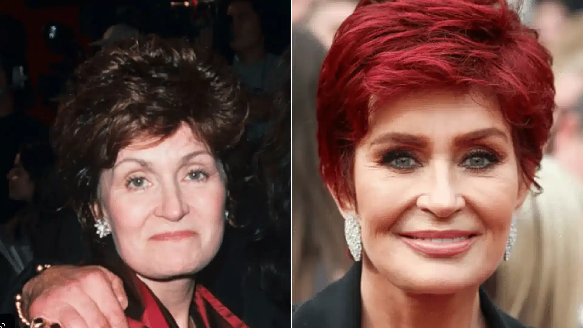 Sharon Osbourne at a public event, featured in a discussion of her facelift experiences and difficult recovery.