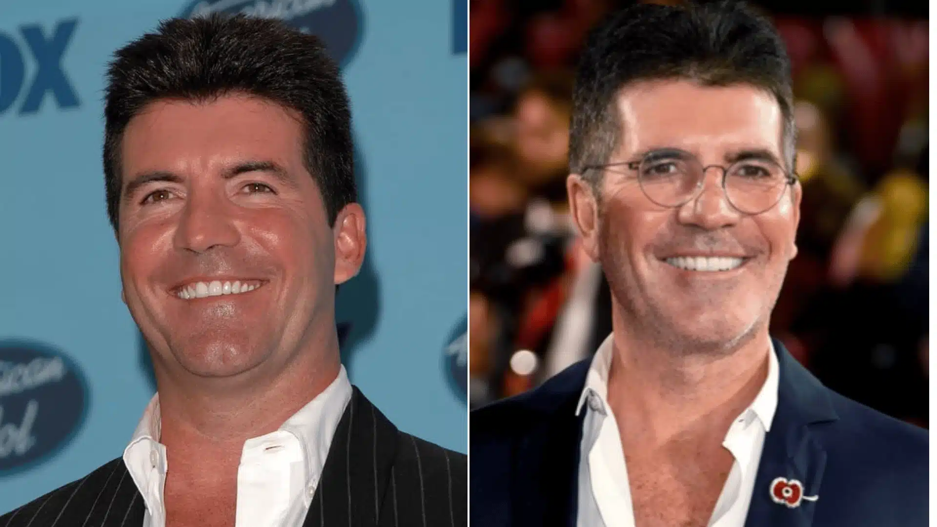Simon Cowell in two smiling portraits, with smaller natural-toned teeth before and a fuller, brighter tooth line after